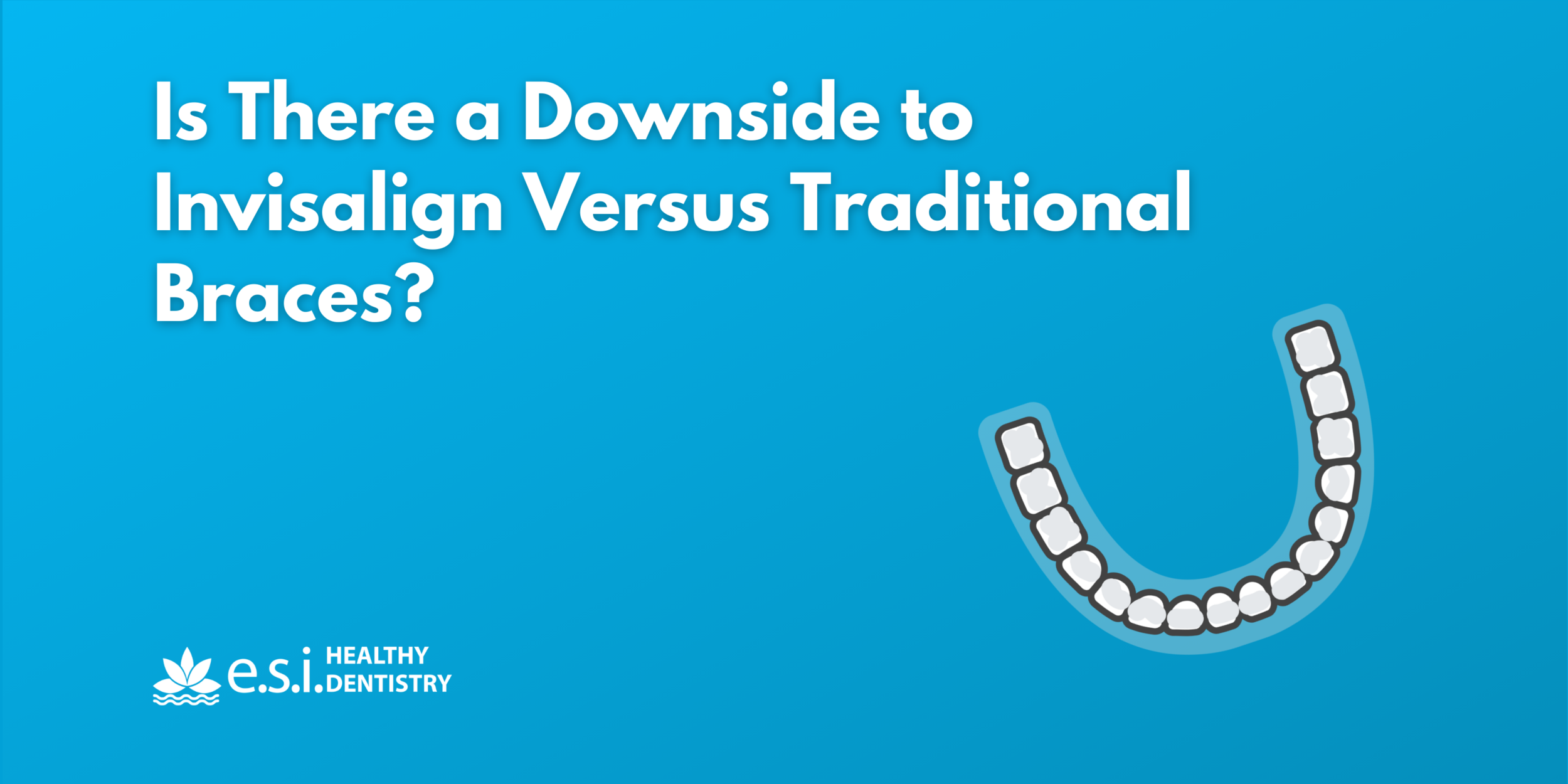 Is There a Downside to Invisalign Versus Traditional Braces?