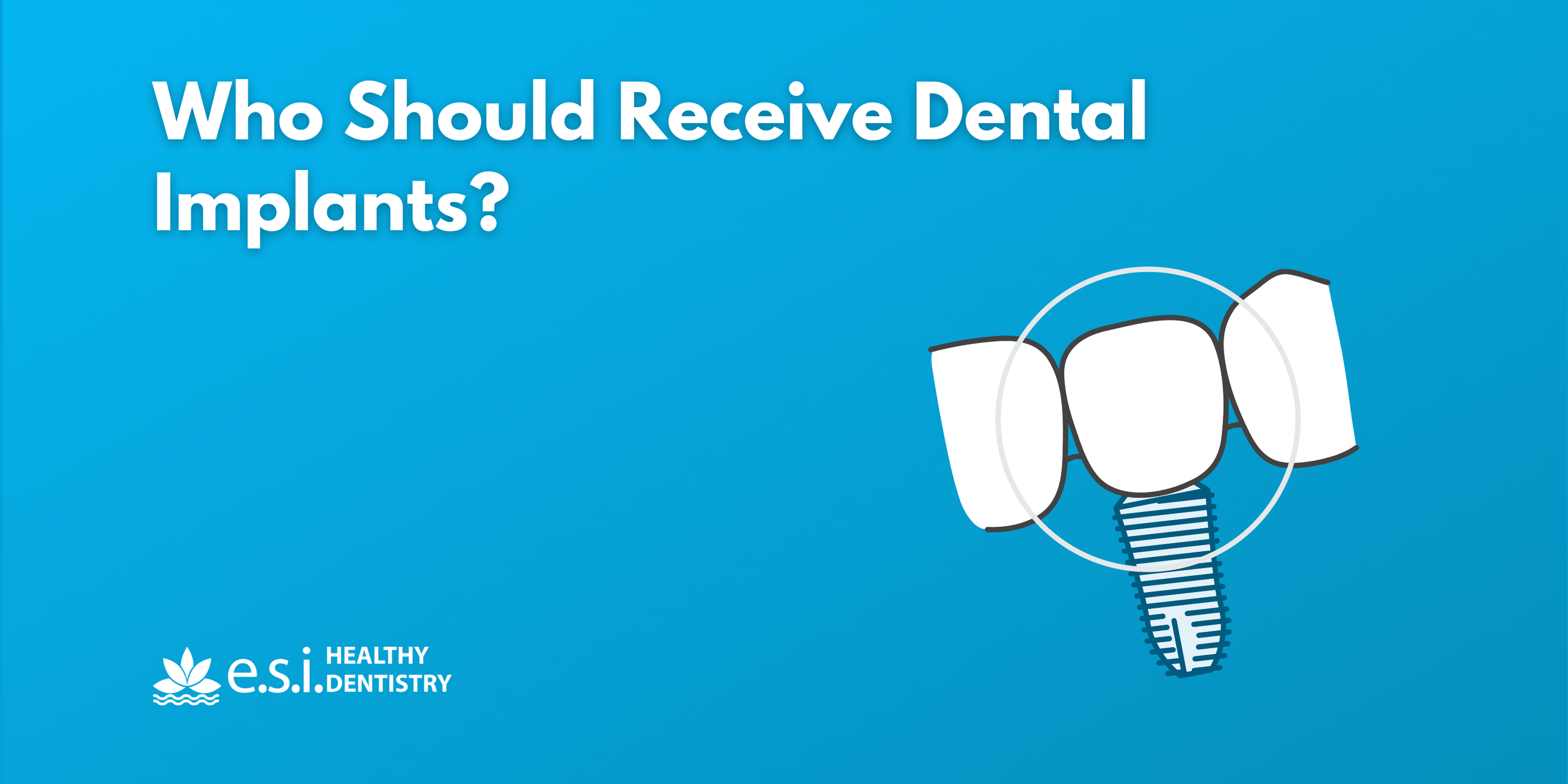 Who Should Receive Dental Implants?