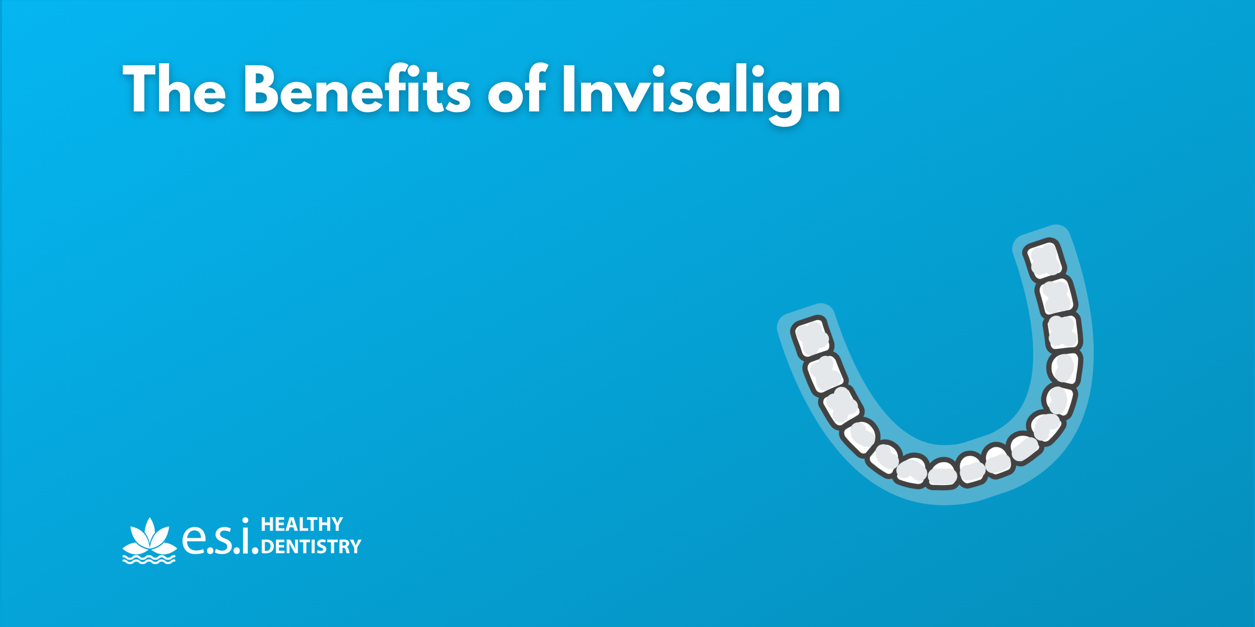 The Benefits of Invisalign