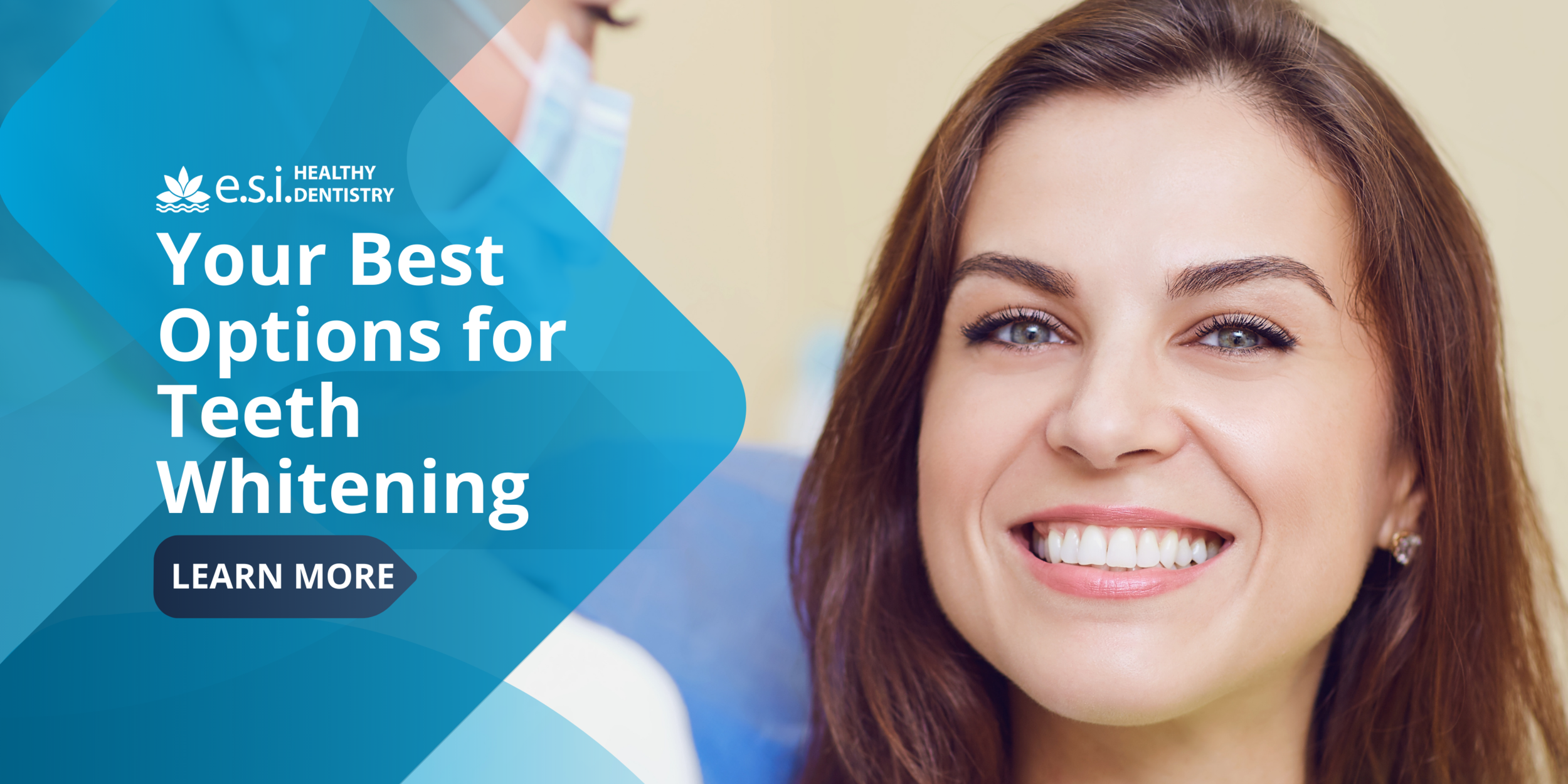 Your Best Options for Teeth Whitening