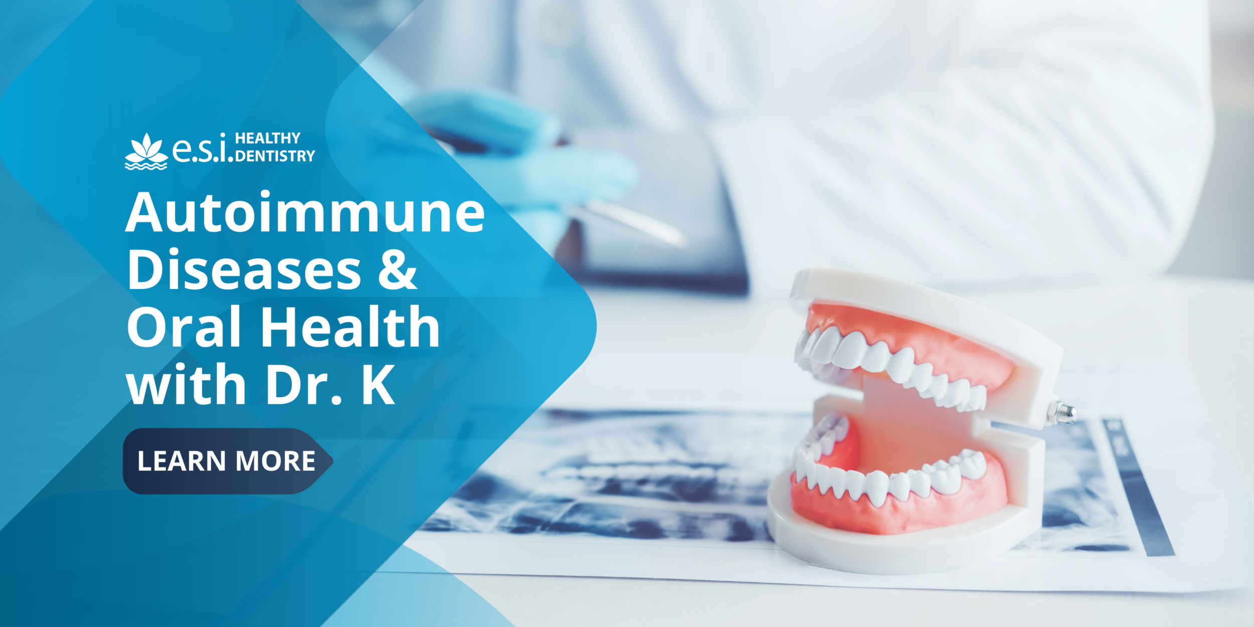 e.s.i.'s Doctor Kilimitzoglou on Autoimmune Diseases and Oral Health