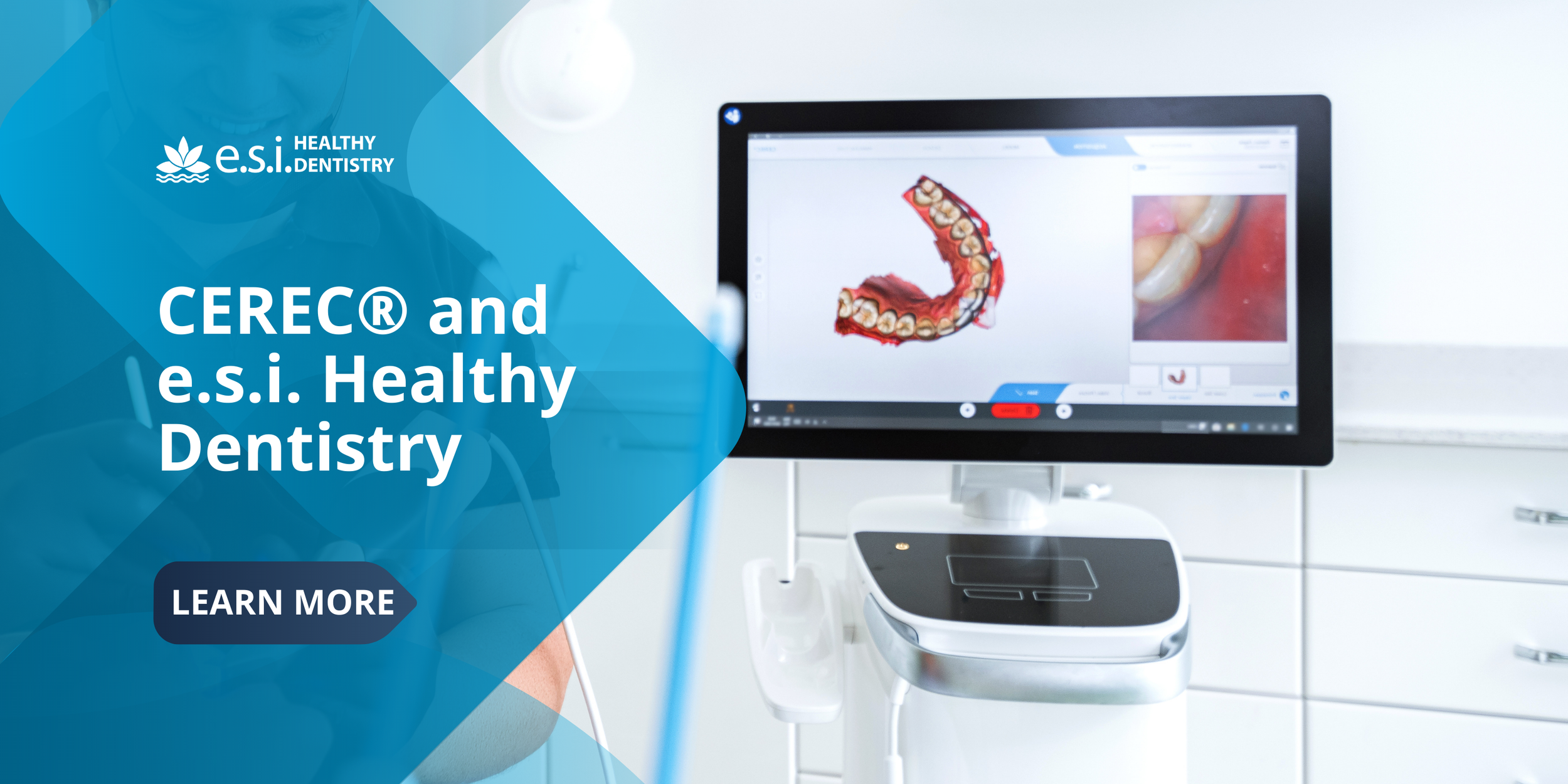 CEREC® and e.s.i. Healthy Dentistry