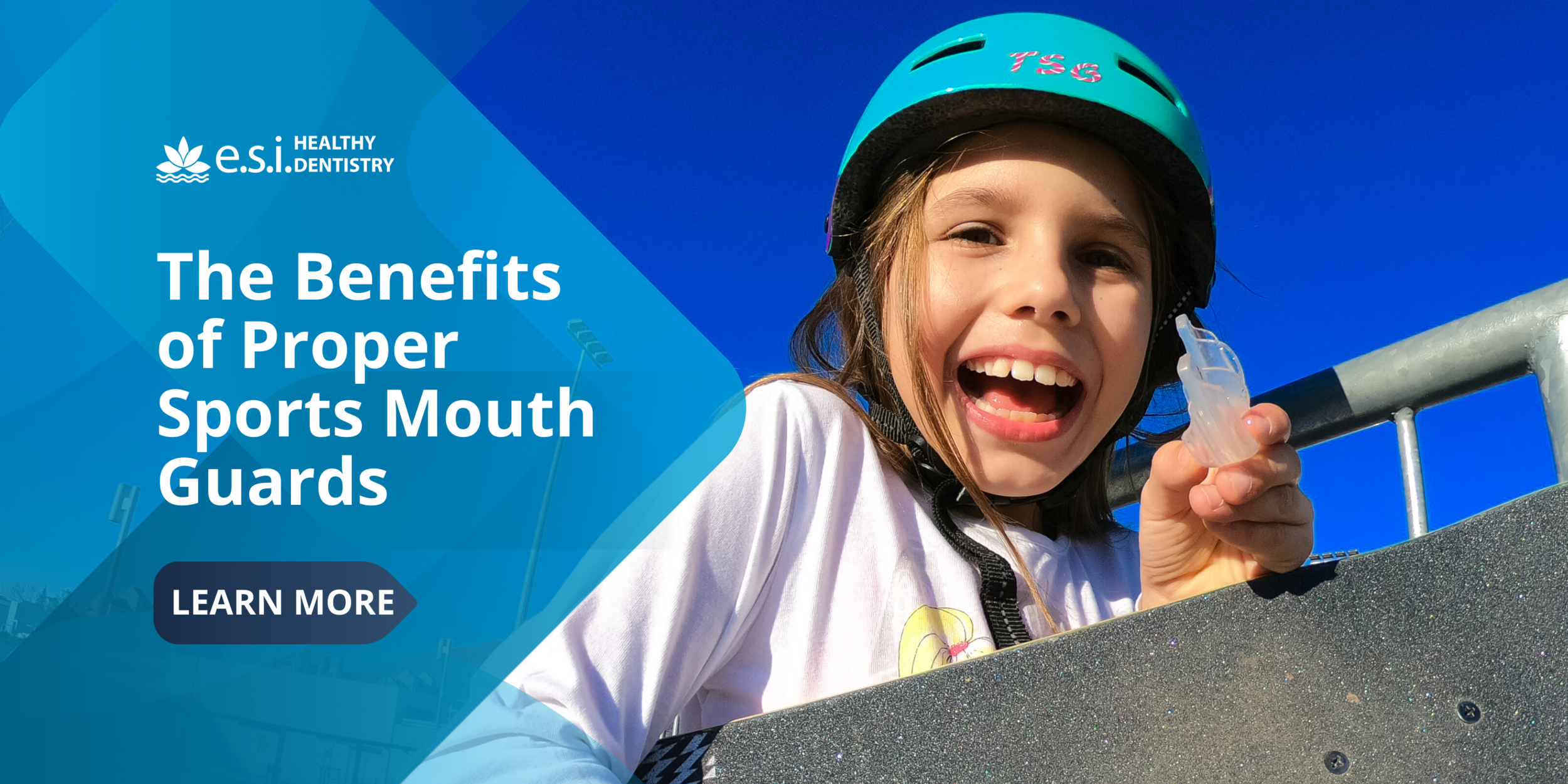The Benefits of Proper Sports Mouth Guards