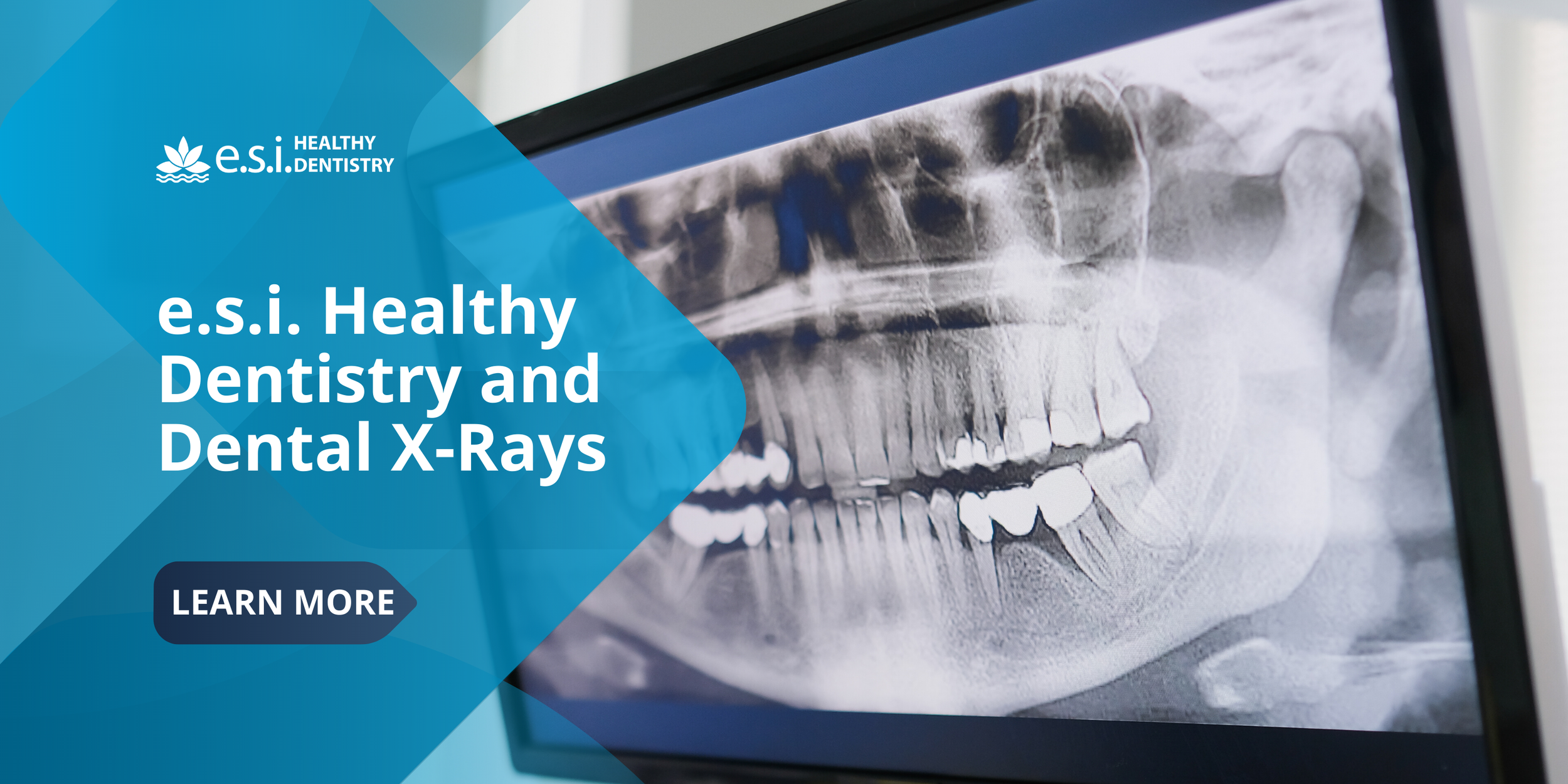 e.s.i. Healthy Dentistry and Dental X-Rays