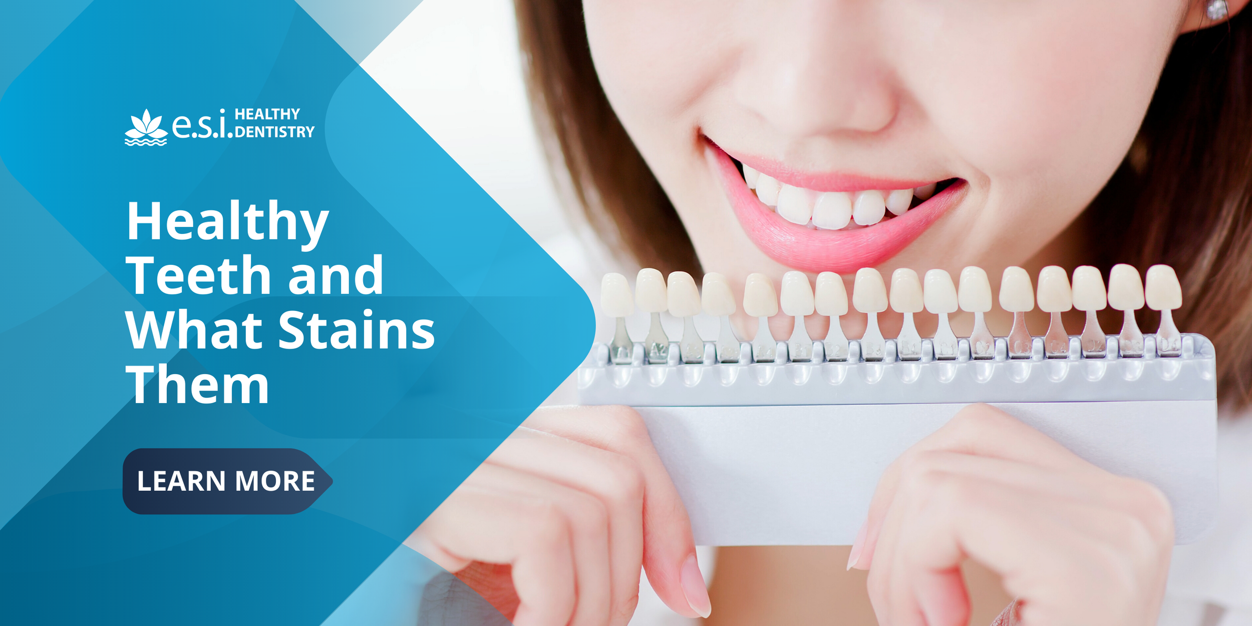 Healthy Teeth and What Stains Them
