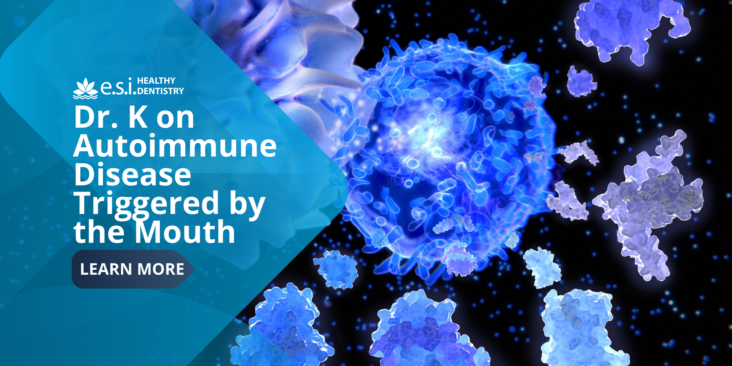 Dr. K on Autoimmune Disease Triggered by the Mouth