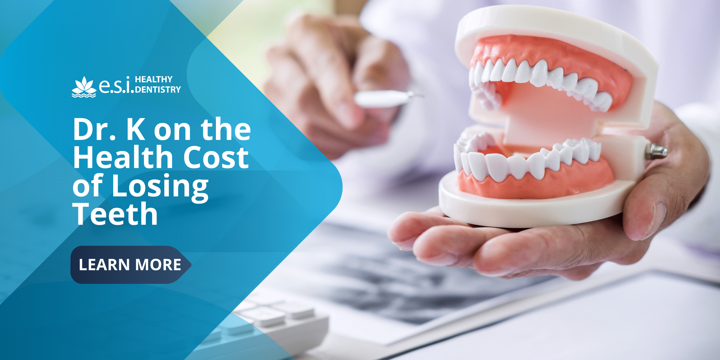 Dr. K on the Health Cost of Losing Teeth