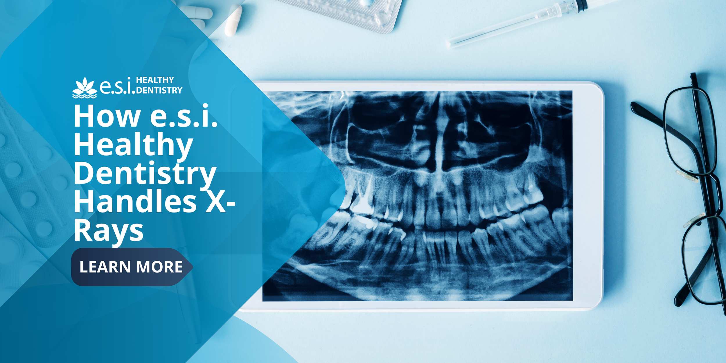 How e.s.i. Healthy Dentistry Handles X-Rays