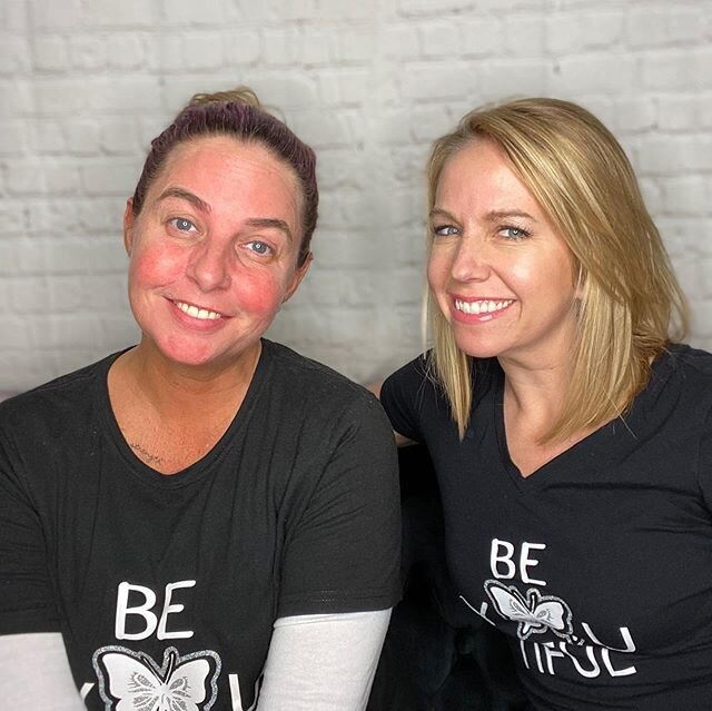 It&rsquo;s #nationalselfieday so we thought we&rsquo;d feature one of our very favorite products - Versa!⁣
⁣
We love how this filler restores youth with minimal recovery time (or pain).⁣..
⁣
Are you selfie-ready this summer?!