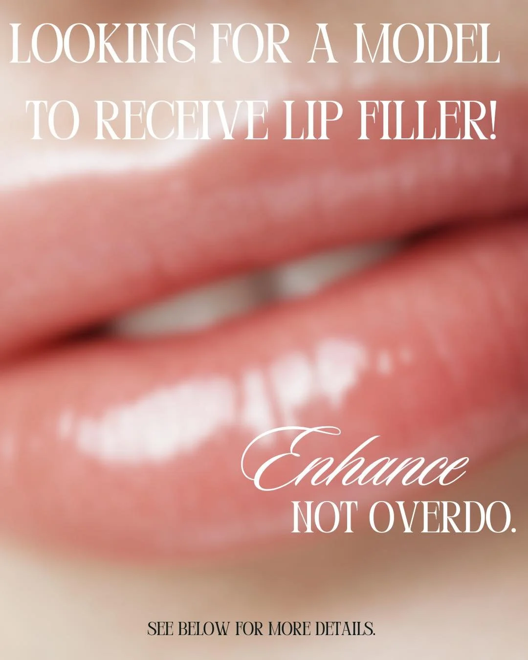💋 We Need a Lip Model! 💋

Want fuller, beautifully enhanced lips? We&rsquo;re choosing 1 model for a lip filler appointment on Friday, January 2nd (10&ndash;12 PM).

To qualify:
✔️ Send a picture of your lips for screening
✔️ $50 refundable deposit