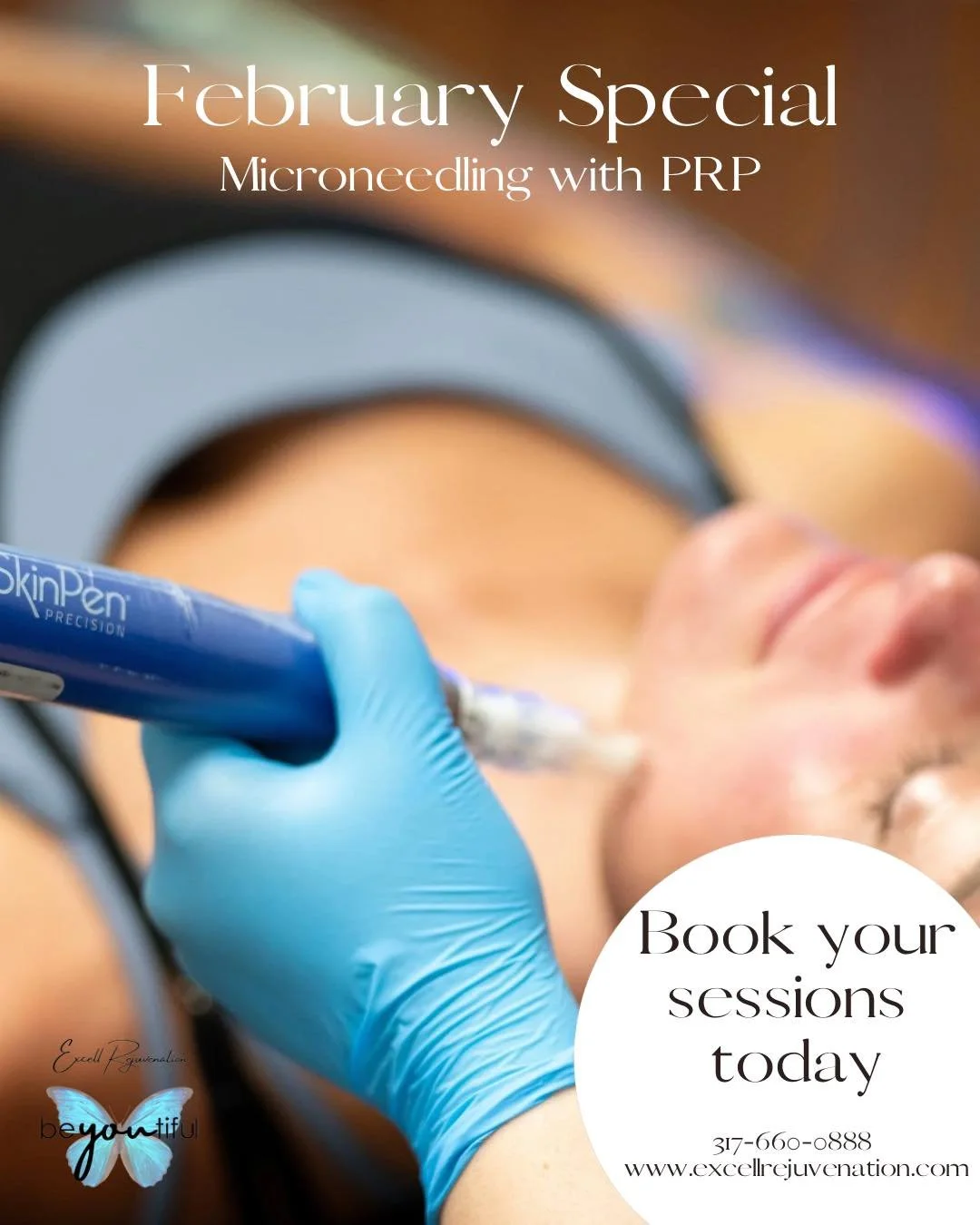 💖 February Special 💖
3 Microneedling with PRP Sessions for $1,350
🎁 PLUS a $100 SkinPen e-Gift Card

Upgrade your results with PRP (platelet-rich plasma) to accelerate healing, boost collagen production, improve skin tone and texture, and enhance 