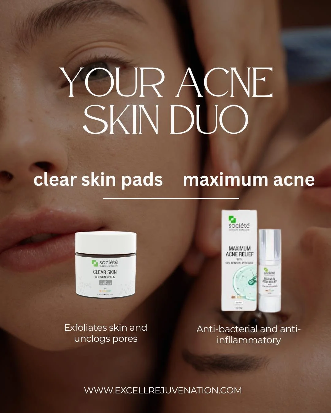 Clear skin starts with the right duo ✨

Our go-to for acne-prone skin:
🦋 Societe Skincare Clear Skin Boosting Pads &ndash; gently exfoliate, unclog pores &amp; reduce buildup
🦋 Societe Skincare Maximum Acne Relief &ndash; targets breakouts, calms i