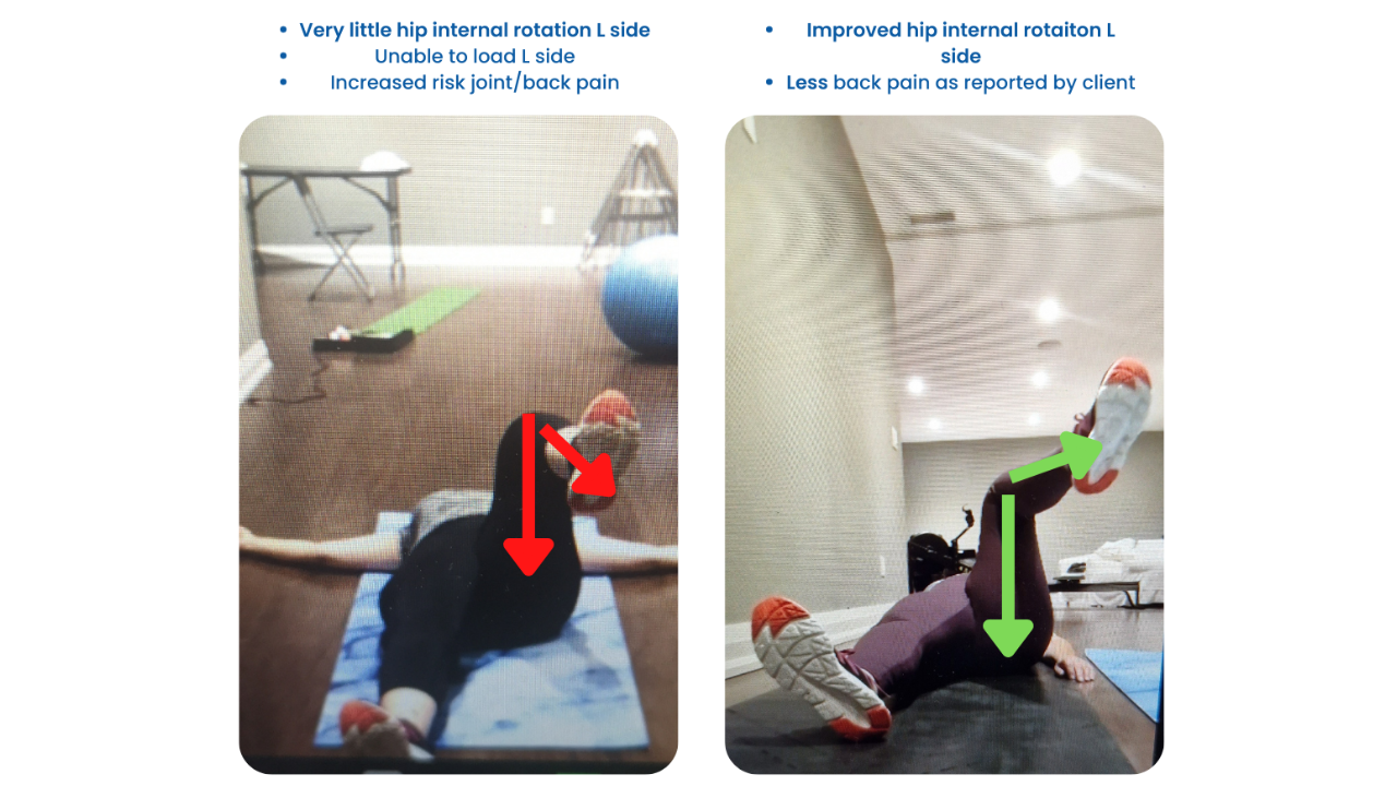 Client Case Hip Improvement