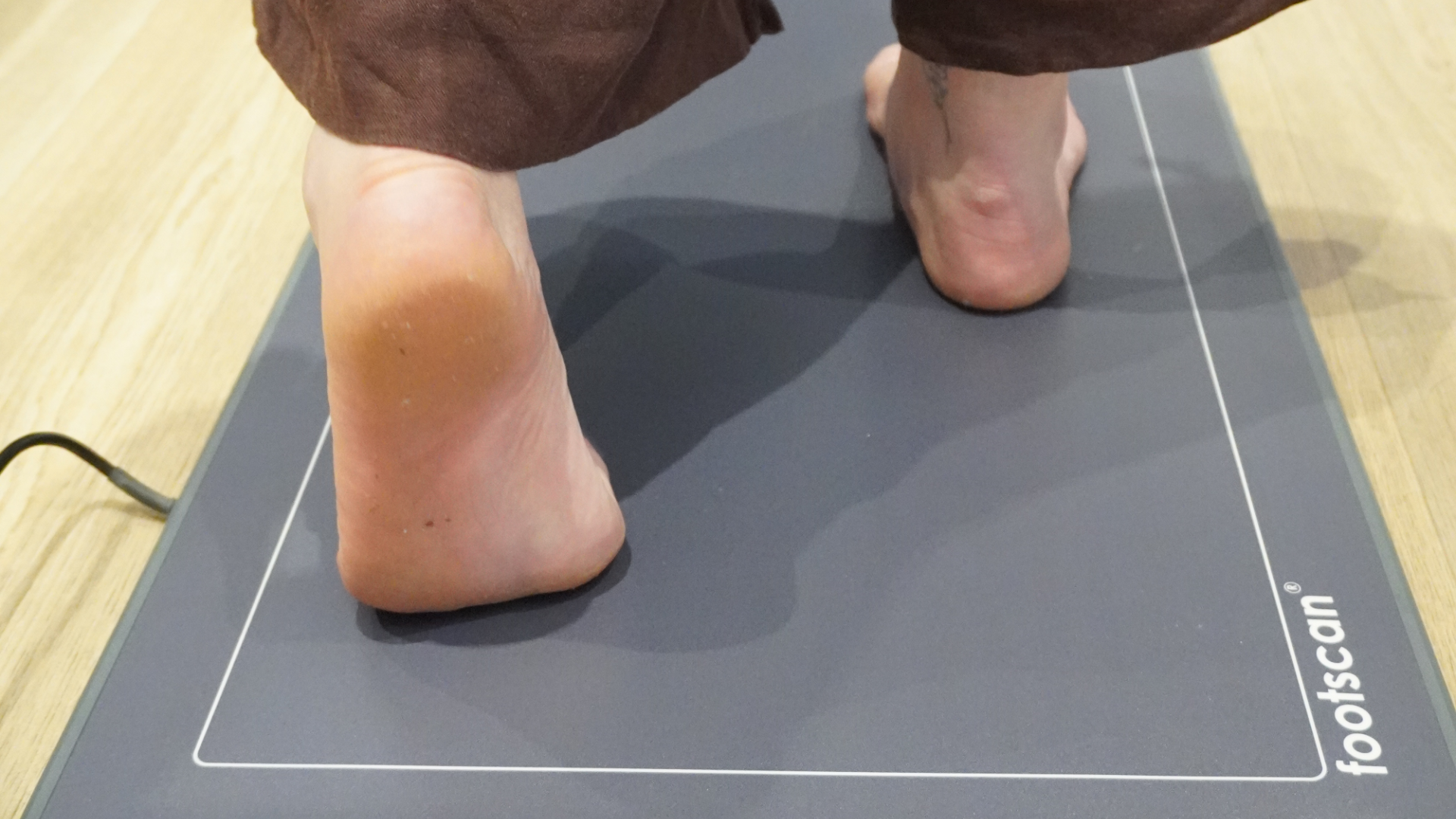 footscan gait analysis