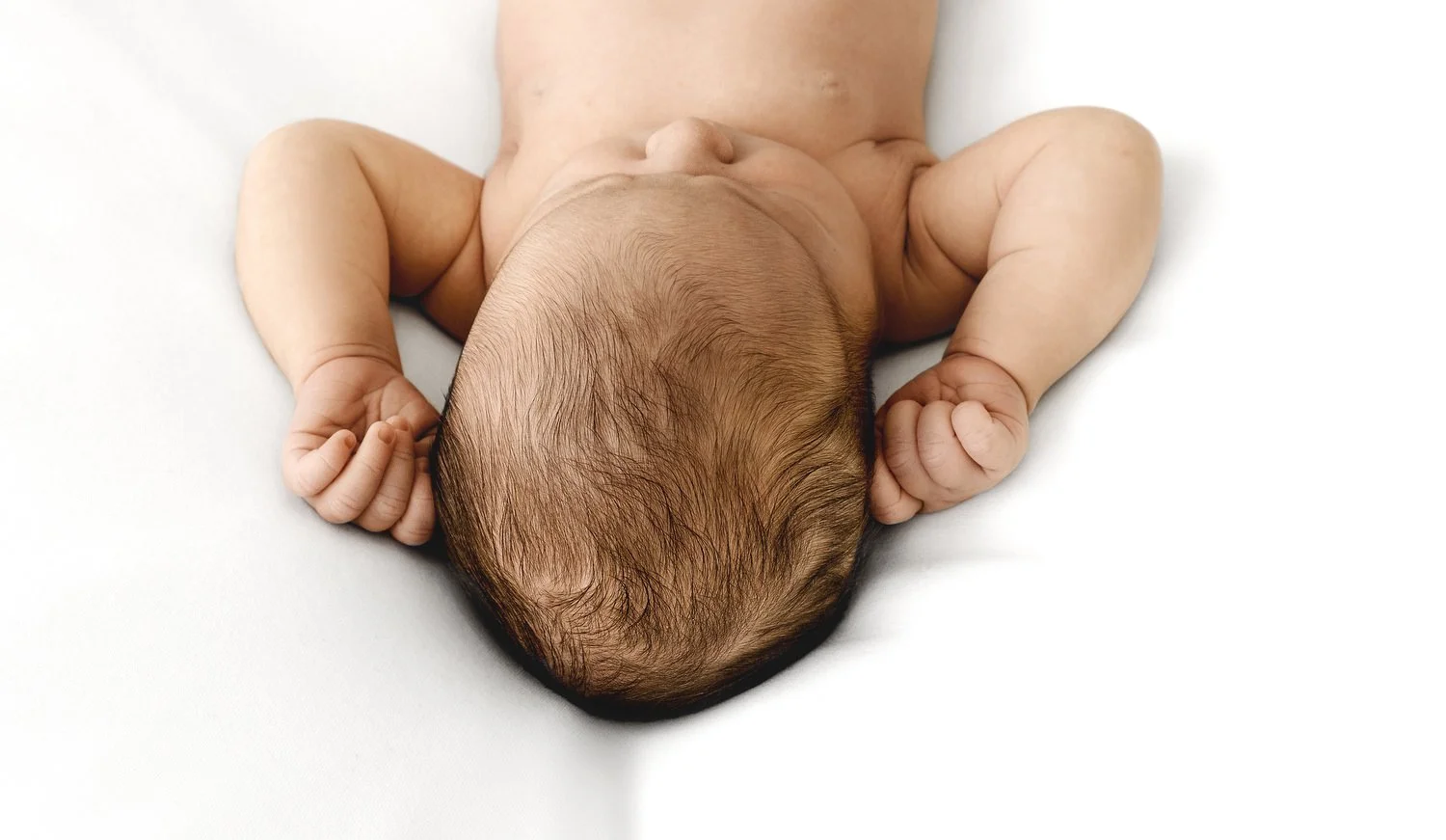 Cradle Cap and Newborn Photographs