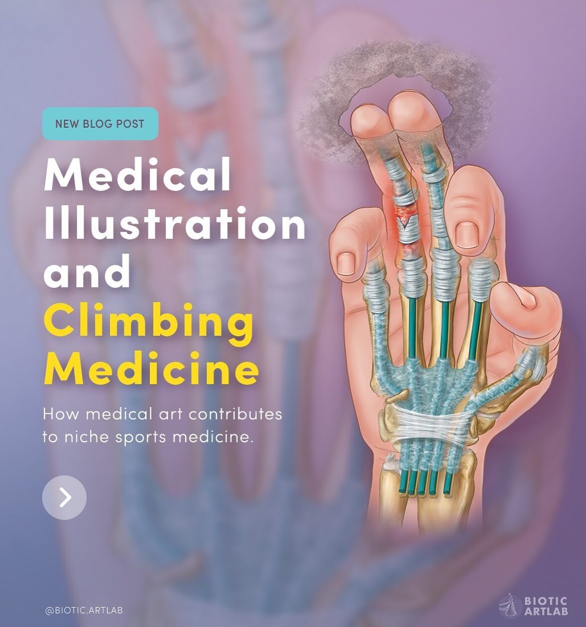 The Tokyo 2021 Summer Olympics are right around the corner and it is the first year that rock-climbing 🧗🏻&zwj;♀️is represented! With climbing on the mind, we have a new blog post that talks about how how medical illustration can work to bring expos