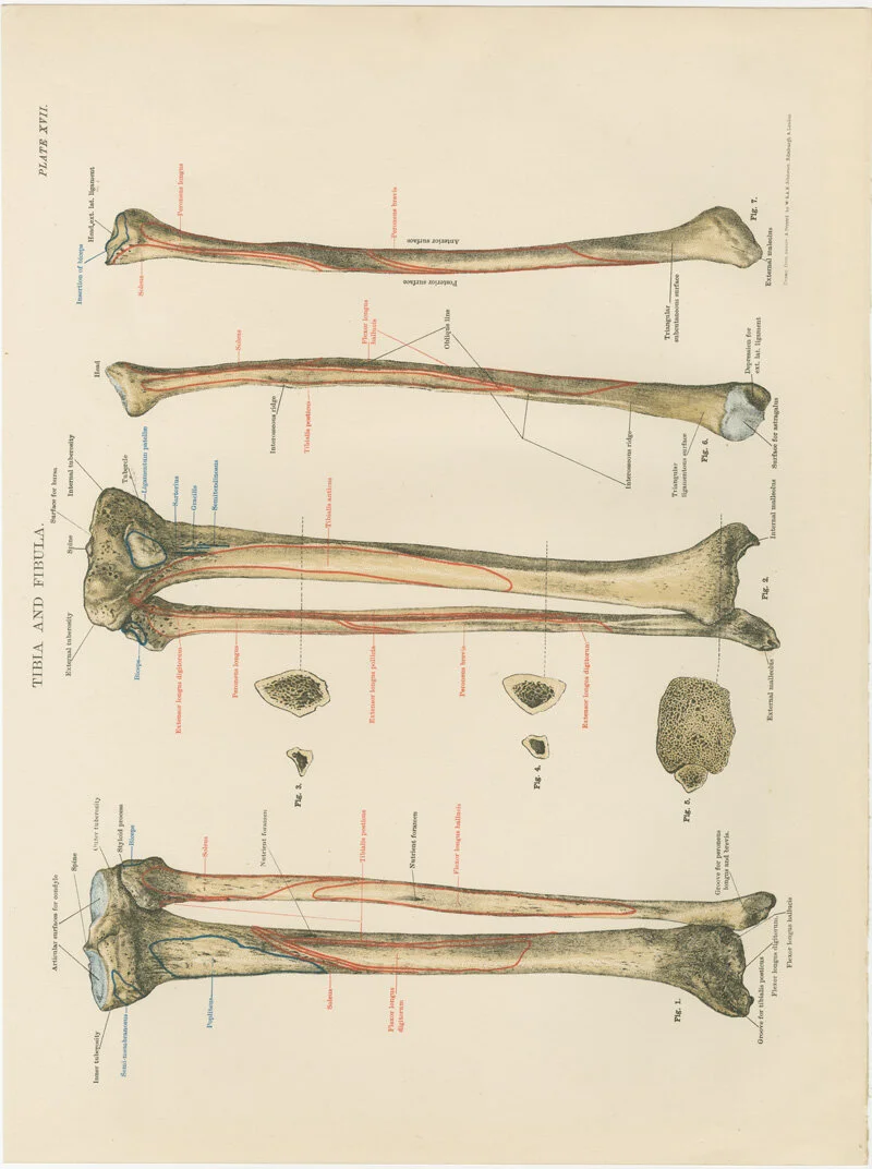 tibia and fibula plate XVII.jpg