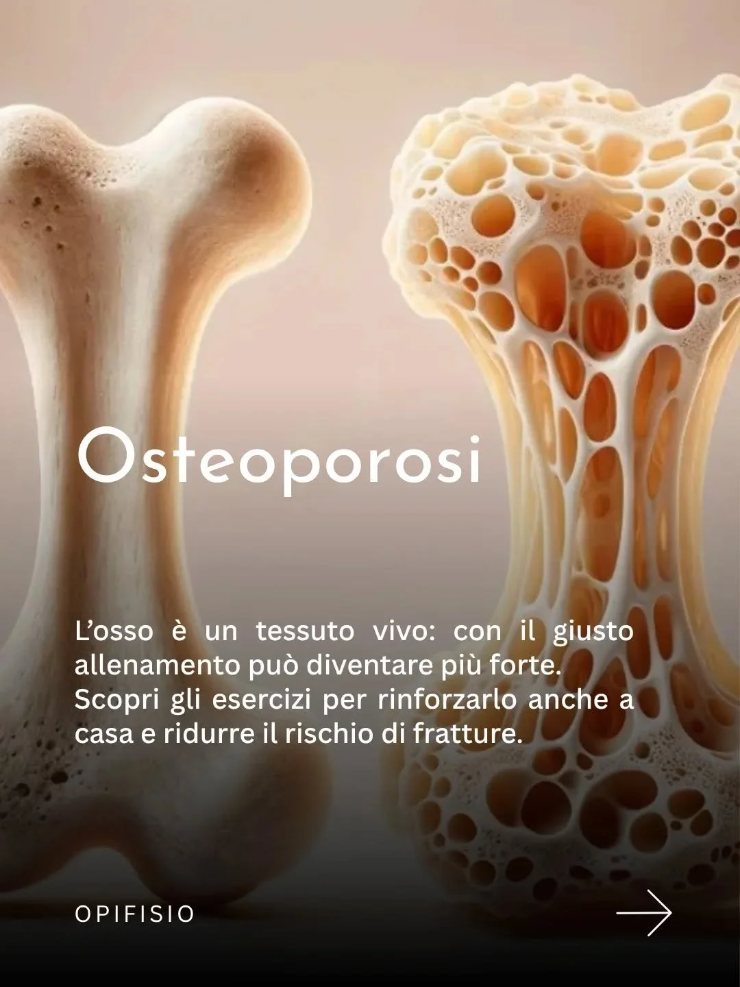 C&rsquo;&egrave; una convinzione diffusa che chi soffre di osteoporosi debba muoversi poco, con cautela ed evitando ogni sforzo. &Egrave; comprensibile, ma non &egrave; corretto. La ricerca scientifica degli ultimi vent&rsquo;anni &egrave; chiara: l&