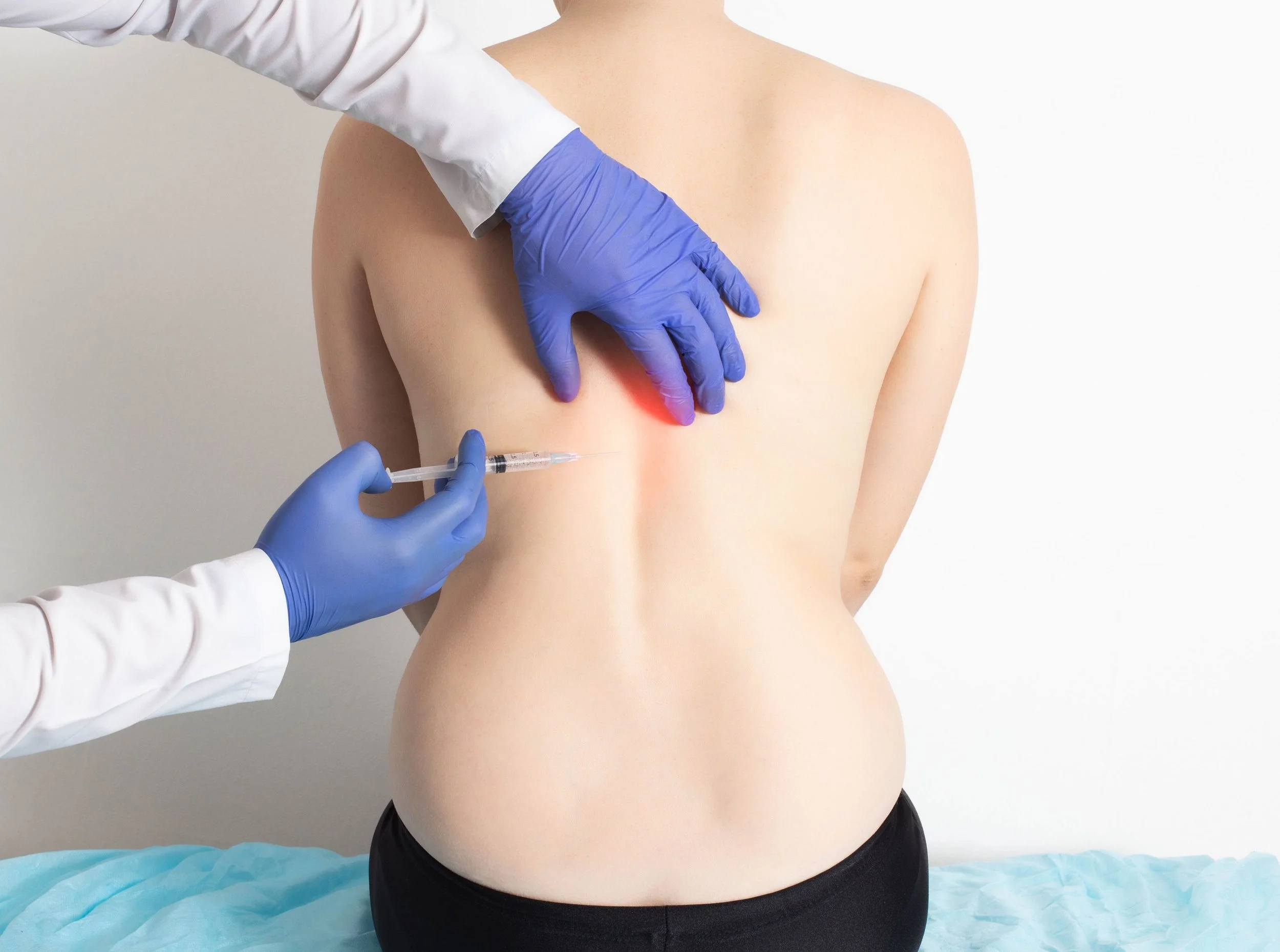 Ozonoterapia per mal di schiena, lombosciatalgia e cervicobrachialgia: come funziona