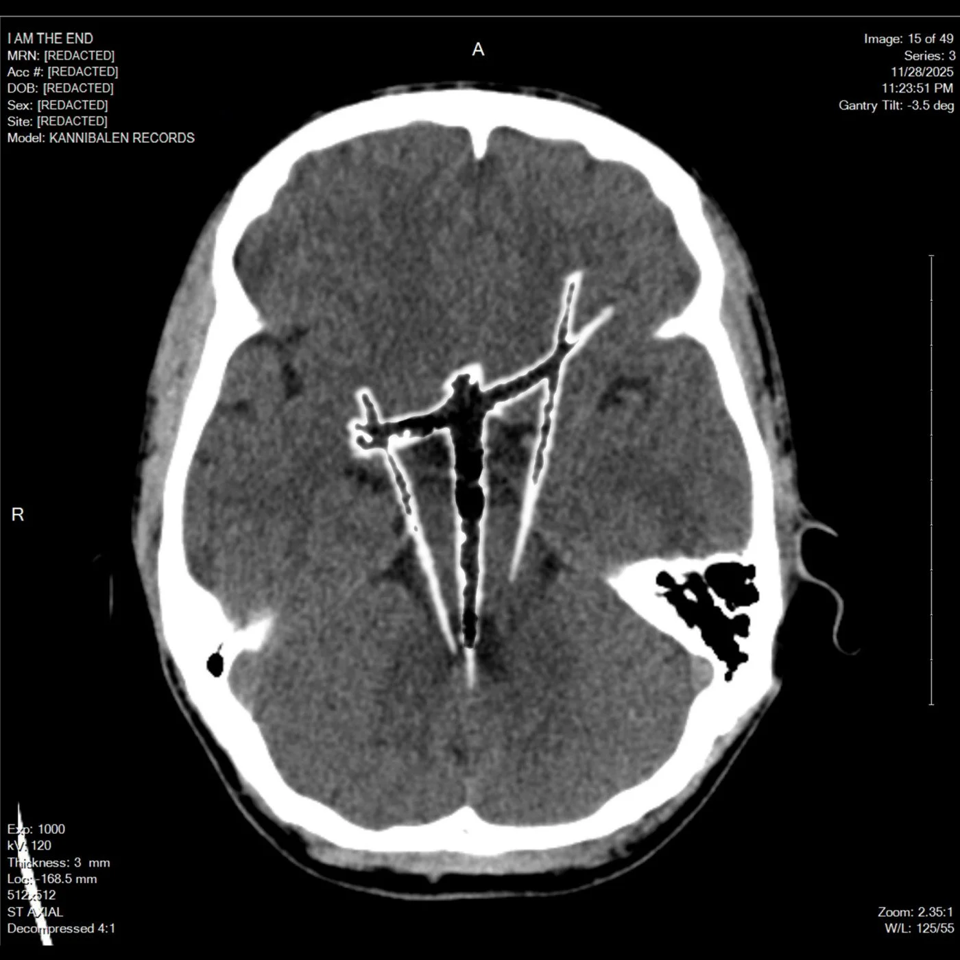 ANTAGONIZER_KANNI24f6a46dfa0b46d6489e1d3f7a021175.jpg