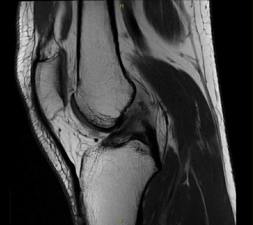 20260305_013051866_iOS 1.jpg