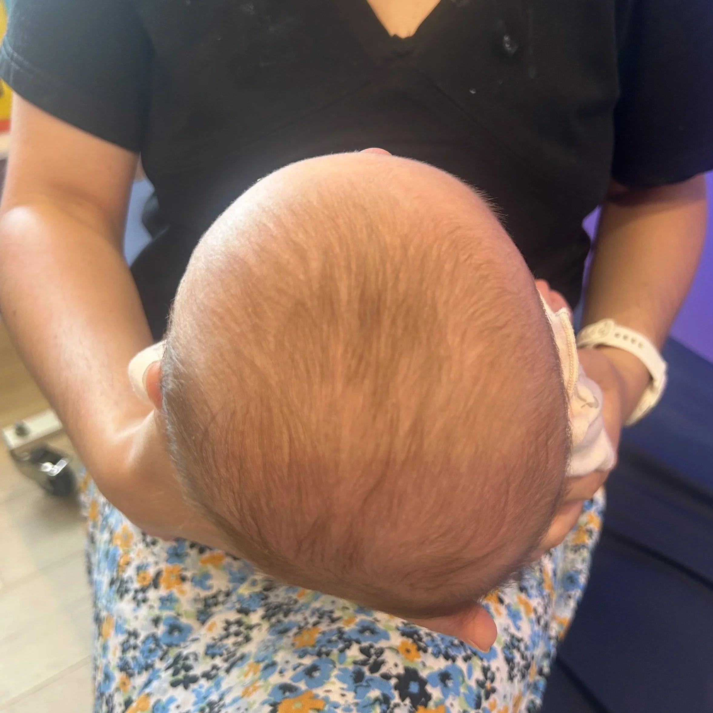 PLAGIOCEPHALY UPDATE 2026
