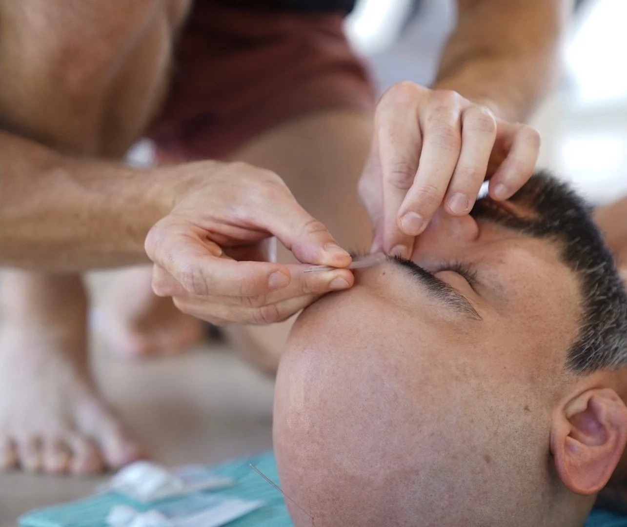 Acupuncture &amp; PTSD: Healing Through Neuroplasticity. Do you understand PTSD and Its Impact on the Brain? 