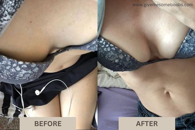Natural Breast Enlargement Success Story in the 30s with Before