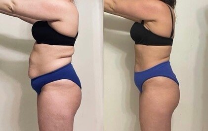 🎊 8 Week Transformation 🎊

&ldquo;I&rsquo;m just really proud. I put in an incredible amount of work on my own &amp; lost 60lbs, I was still soooo unsatisfied. During our weeks together, I learned and accomplished things that I never thought I coul