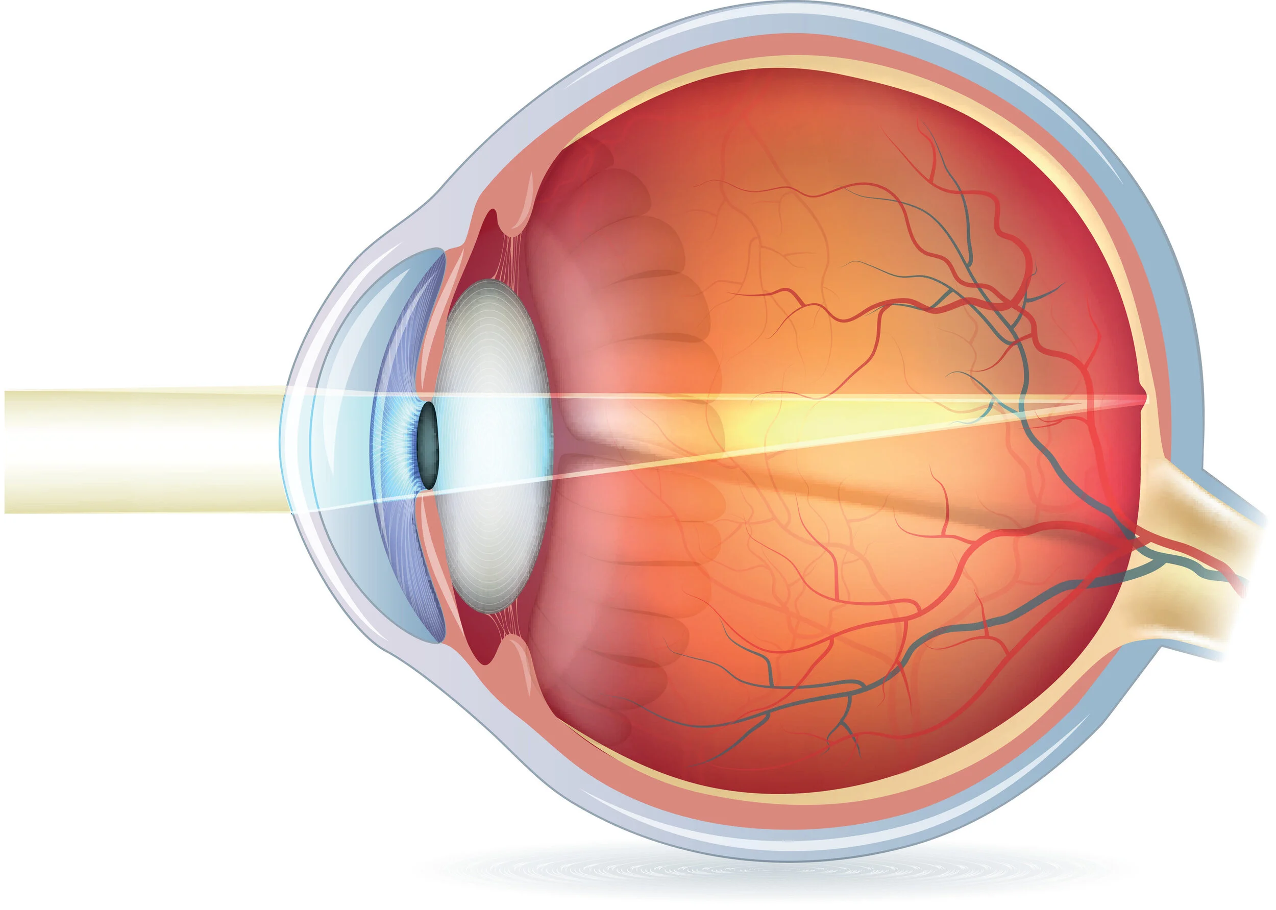 Refractive Error | Enhance Your Vision — Wynne Eye Associates