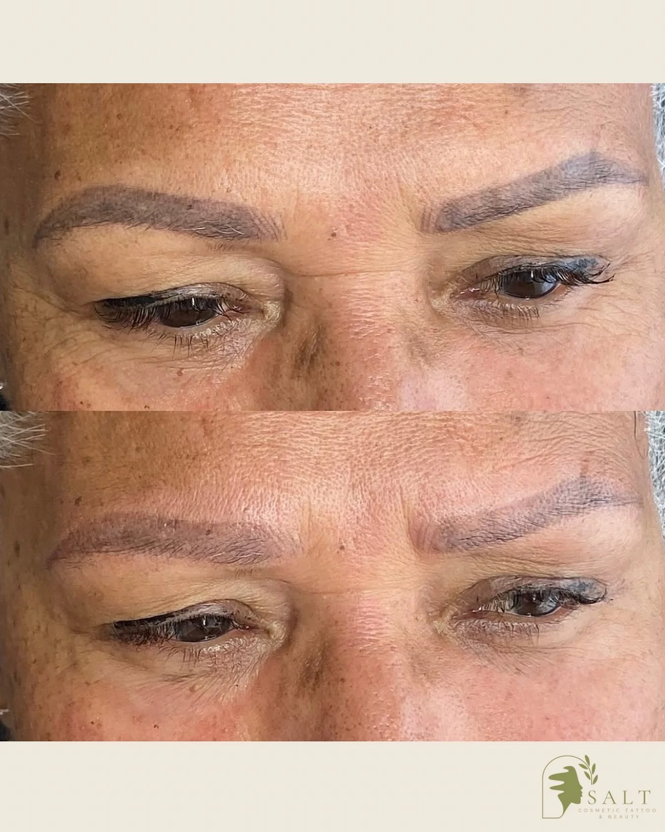 Brow Tattoo Removal - before and immediately after a laser removal session. Laser is quick and efficient with no downtime 👌🏼 If you aren&rsquo;t happy with your old brow tattoo let&rsquo;s chat!