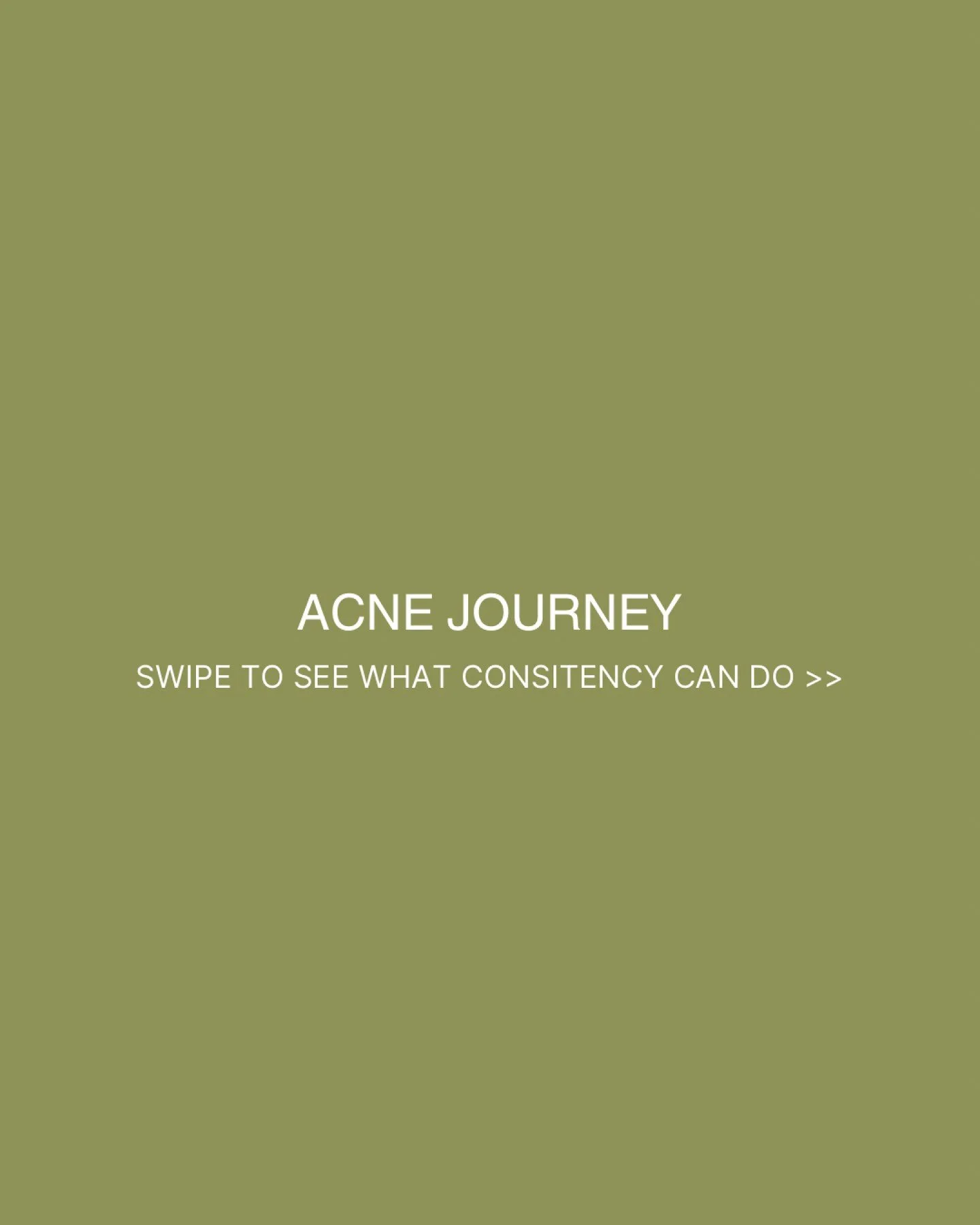 Real skin. Real progress.

Targeted treatments + consistent home care = healthier, clearer skin over time.

Proof that patience and the right plan make all the difference.

Book your complimentary consultation to see how we can help 🤍

.
.
.
#bblfor