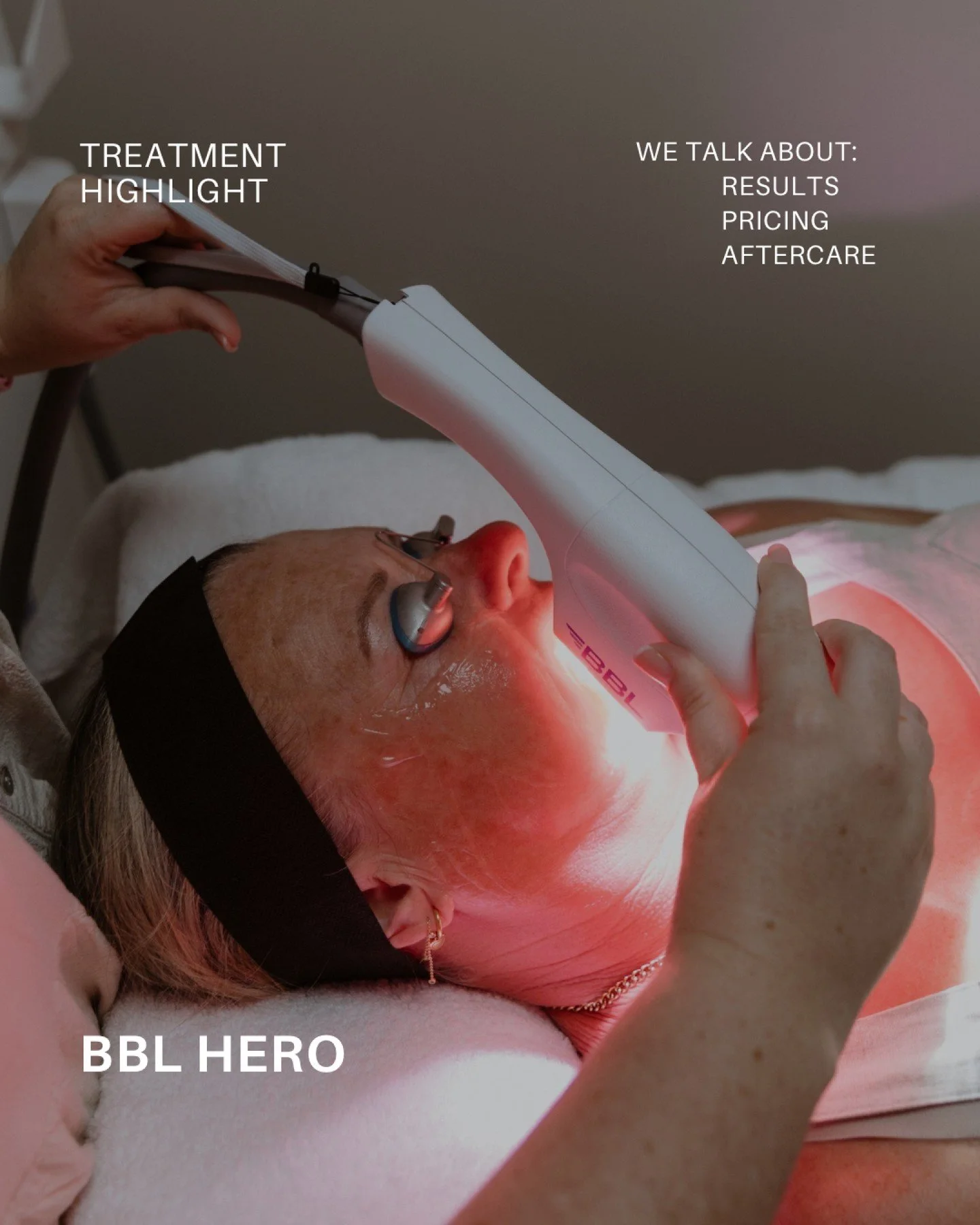 BBL hero treatments are designed to support clearer, smoother, more refined-looking skin. By targeting concerns such as pigmentation, visible redness, uneven texture and enlarged pores, BBL helps improve overall skin clarity and promote a brighter, h