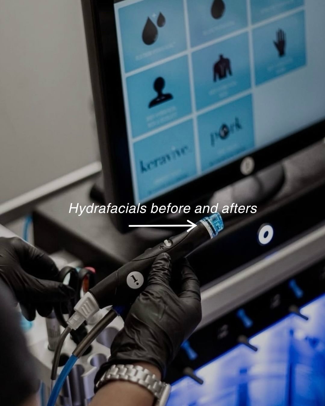 HydraFacial is our go to treatment for instant glow and no downtime ✨ 
Does your skin need a refresh? 

Book your HydraFacial through the link in our bio 🤍