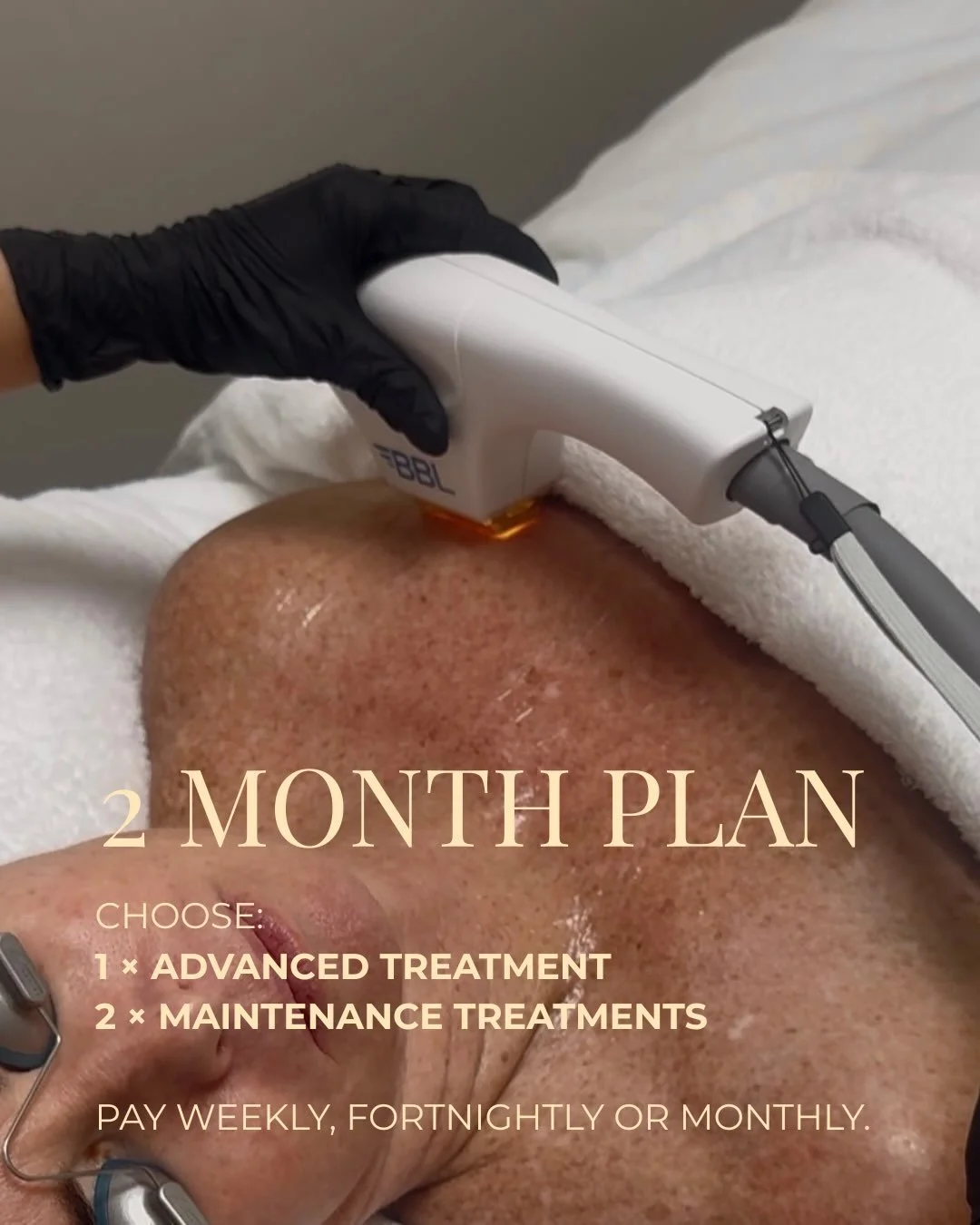 Does your skin feel dull, meh and overall a little lacklustre?

Swipe for an idea for a 2-month Skin Plan to bring it back to life:

1. MOXI
To target pigmentation, even and brighten skin tone and smooth texture.

2. BioRePeel, the following month 
T