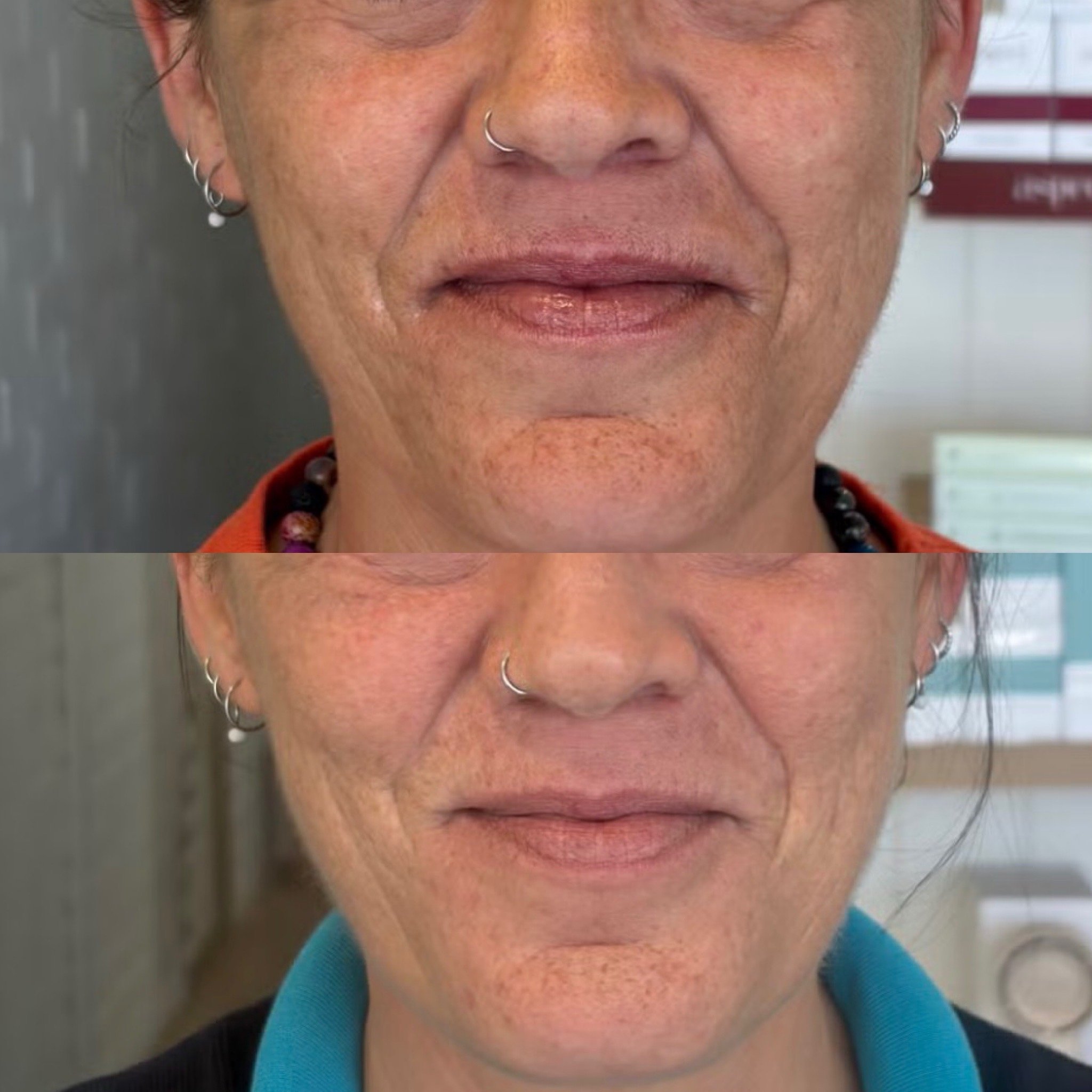 Facetune_14-07-2026-20-31-22.jpeg