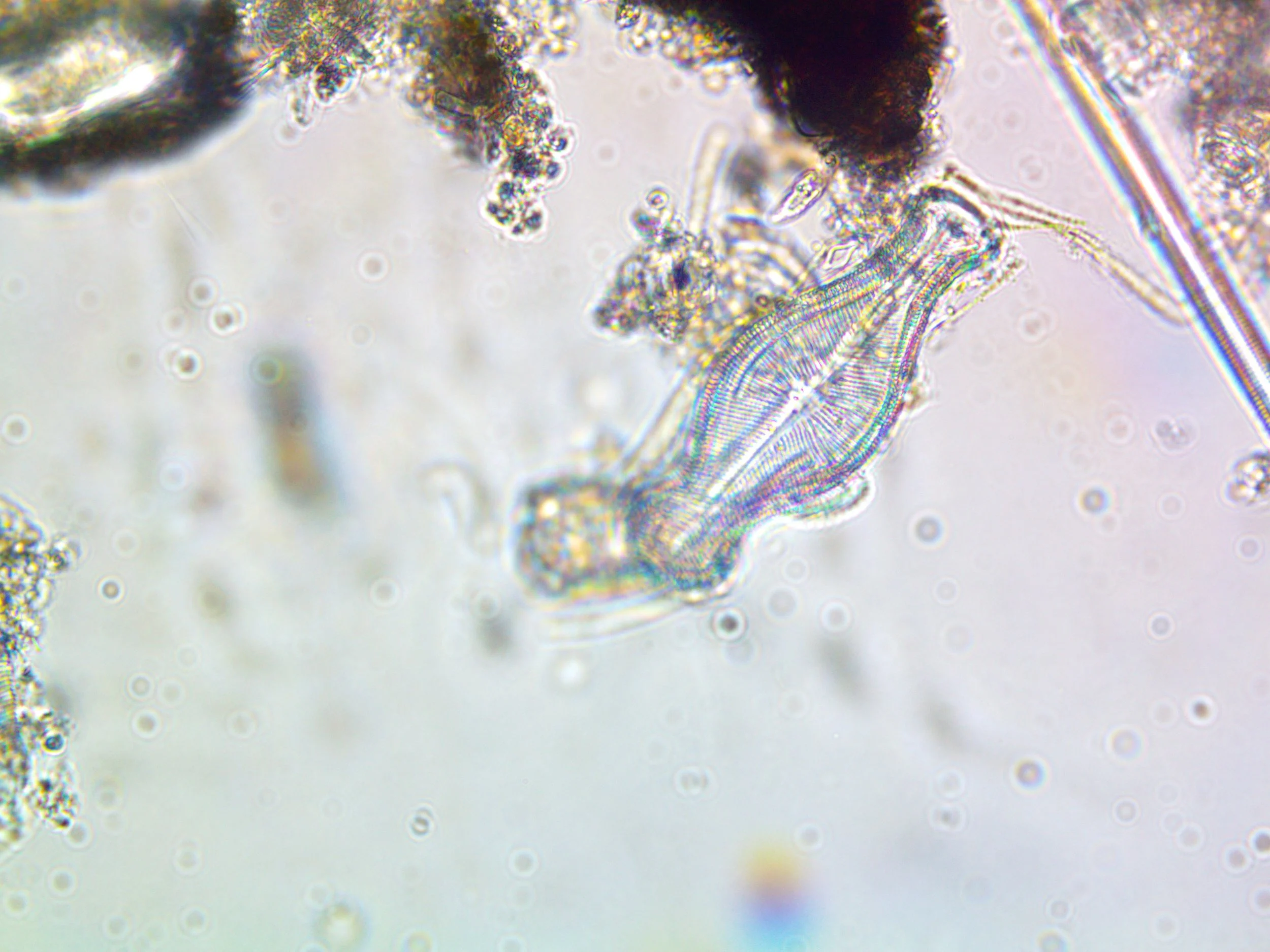 Photo image of a Didymosphenia diatom