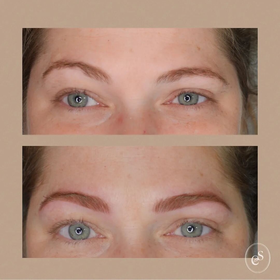 Asymmetry in our facial muscles, bone structure as well as how our natural brow hairs grow can all contribute to how different each brow is from the other

👉🏼 The goal for brow work we can aim toward is to create a bit more balance and the effect o