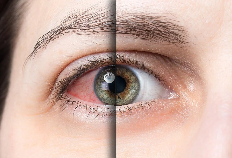 Dry Eyes and Menopause: Why Your Eyes May Feel Gritty, Sore or Watery