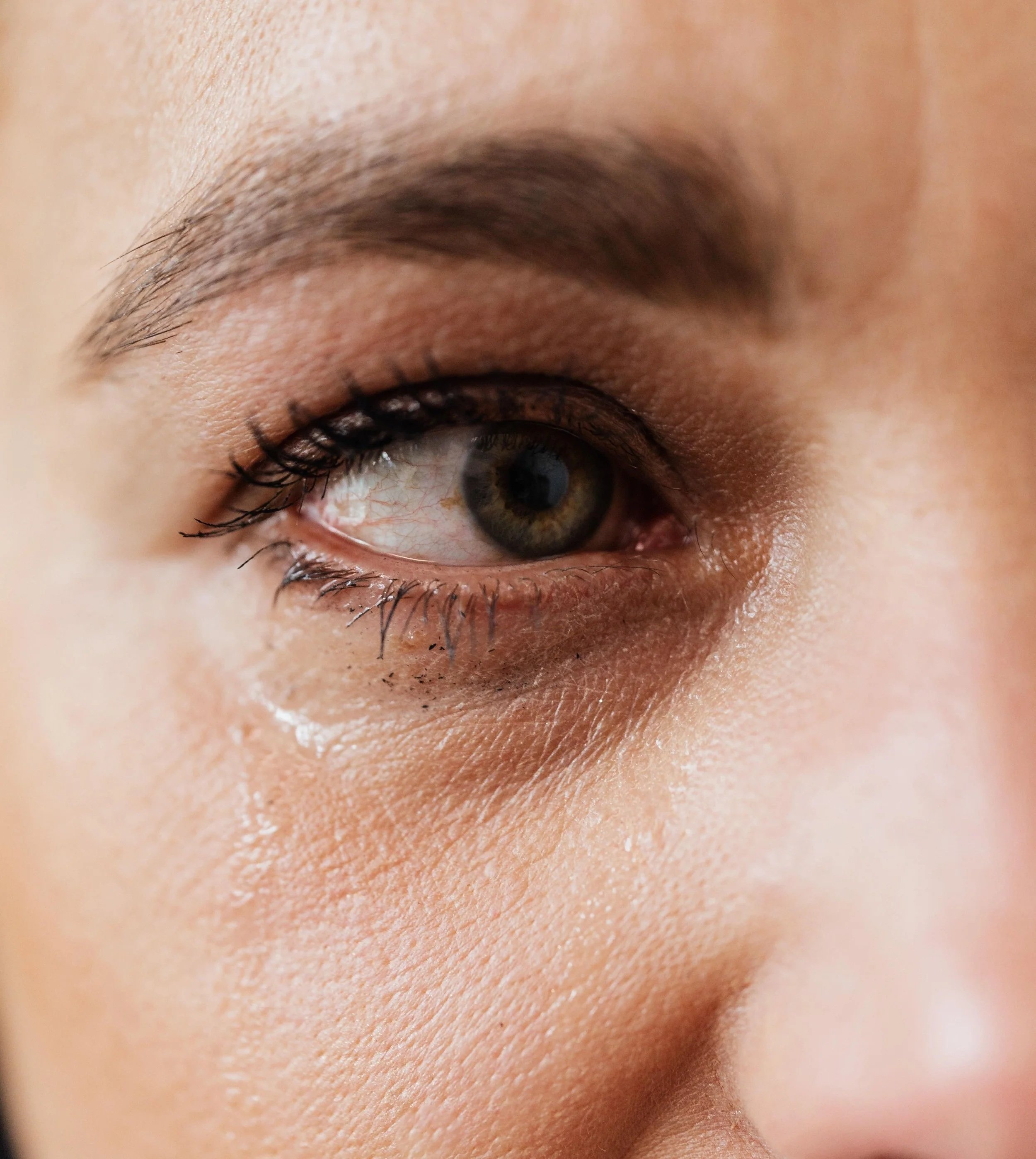 I Nearly Lost My Sight... The Symptoms I Wish Everyone Knew