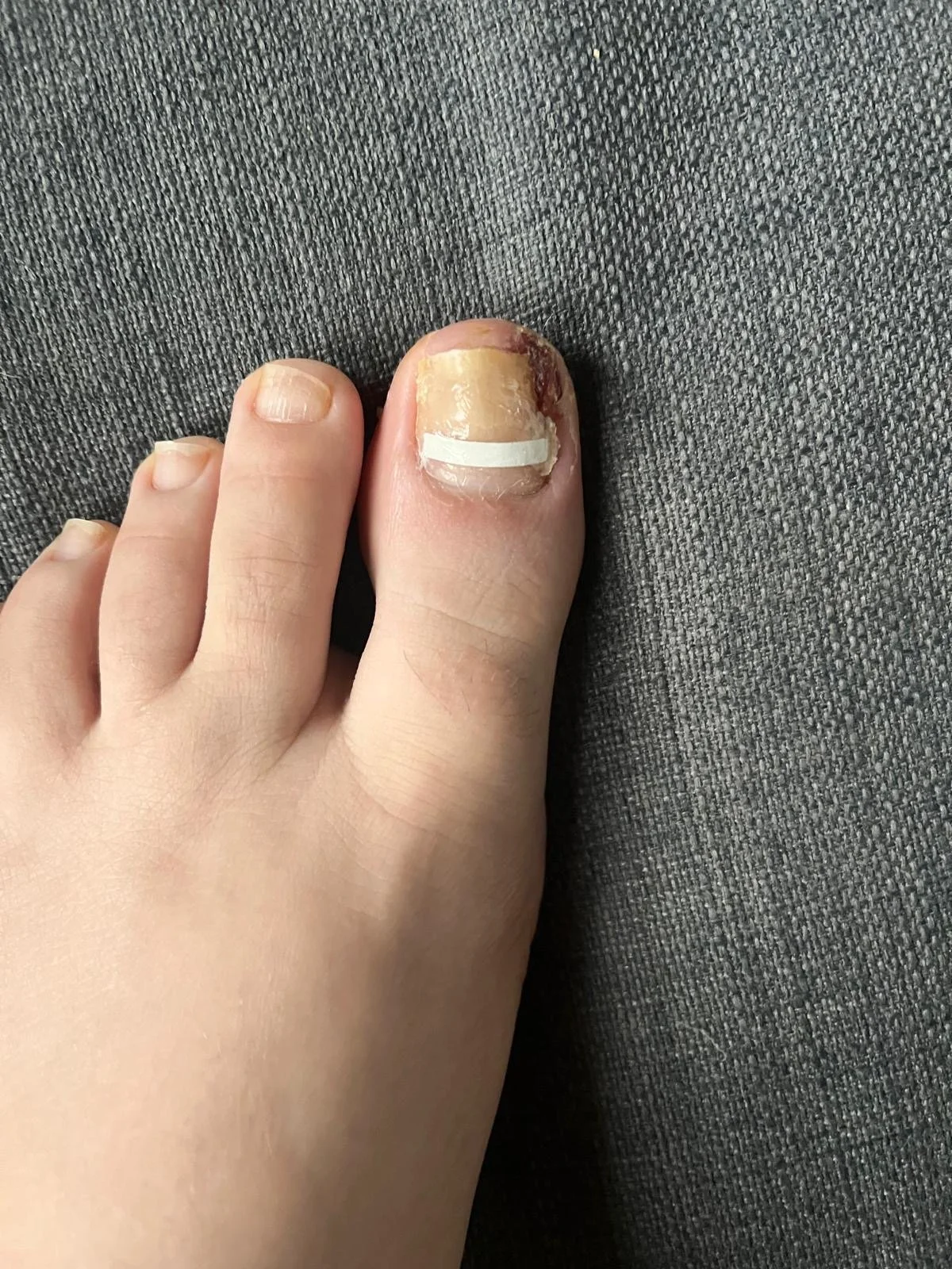 Behandeling cliënt 1 | vóór