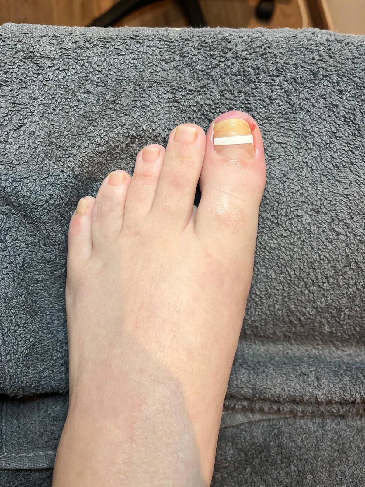 Behandeling cliënt 1 | na