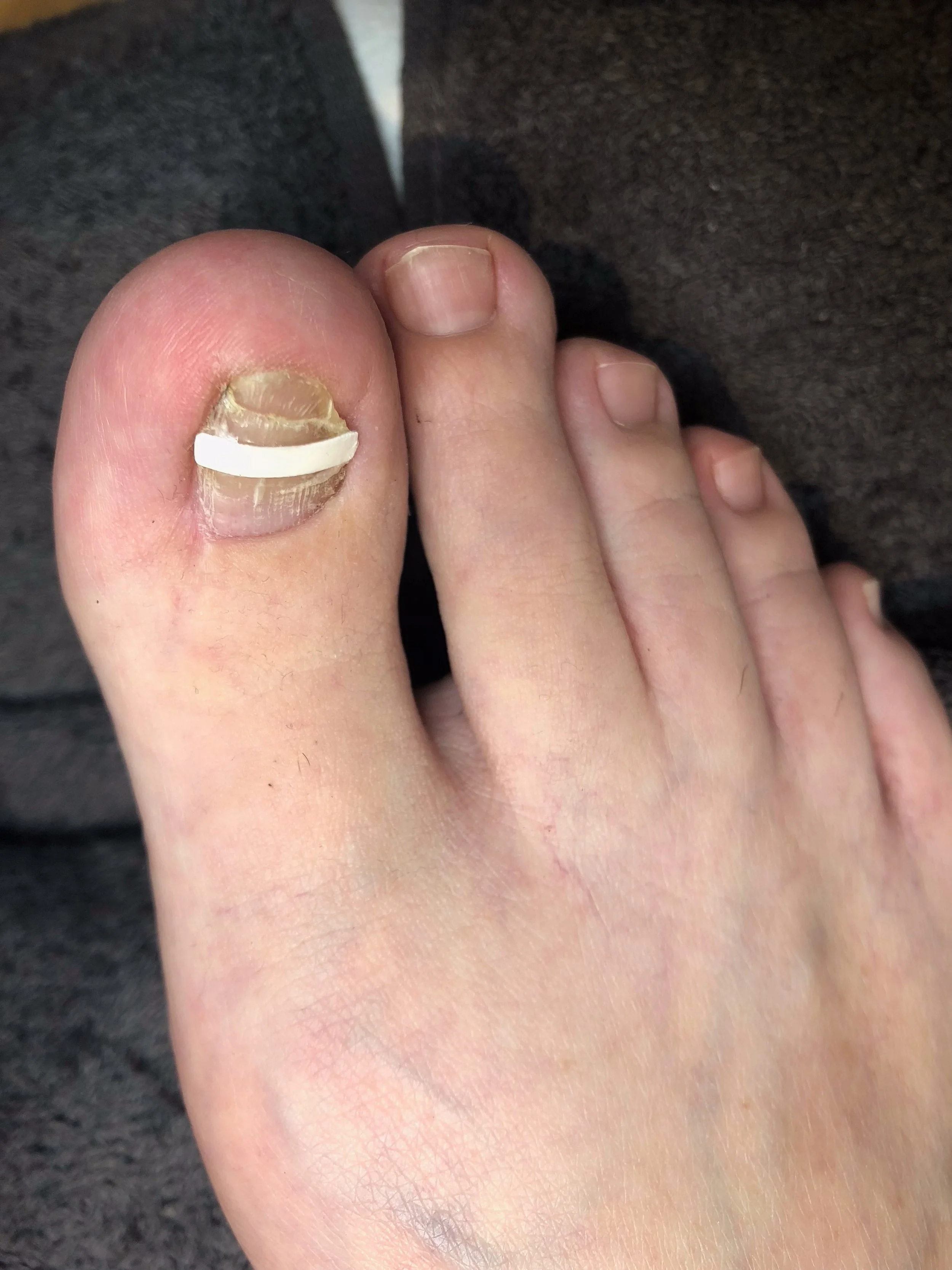 Behandeling cliënt 1 | na