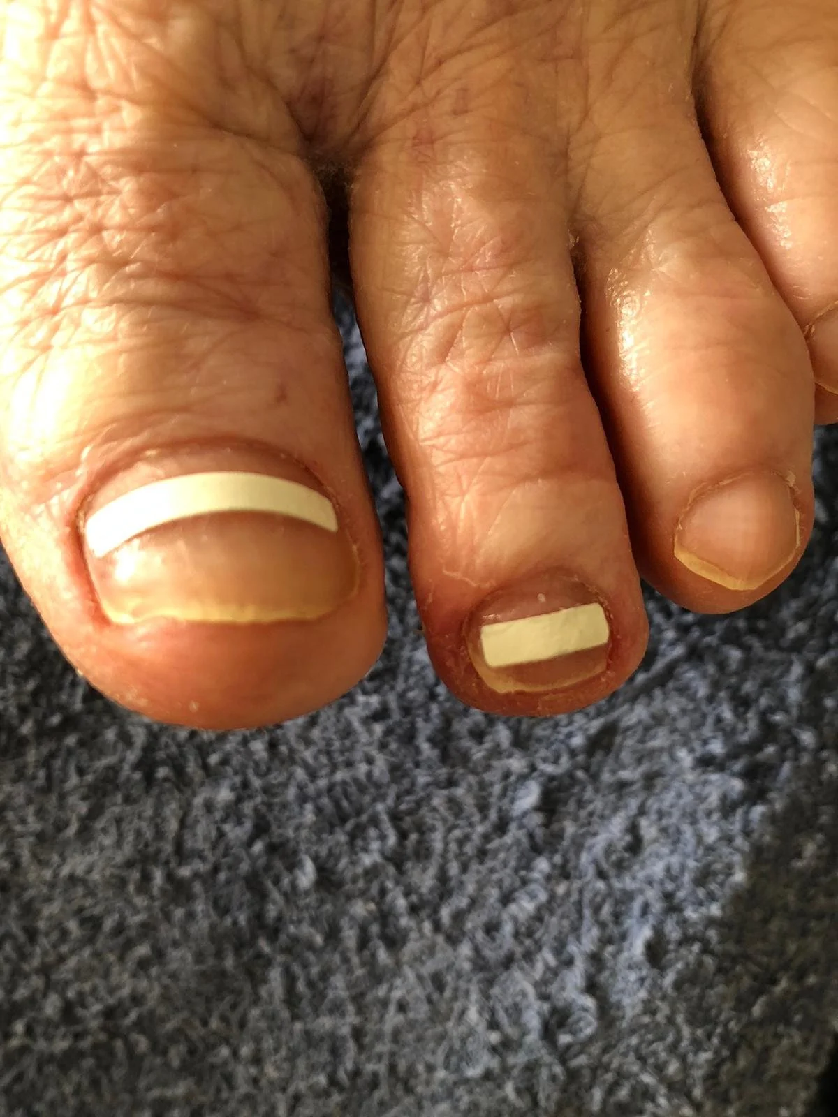 Behandeling cliënt 2 | na