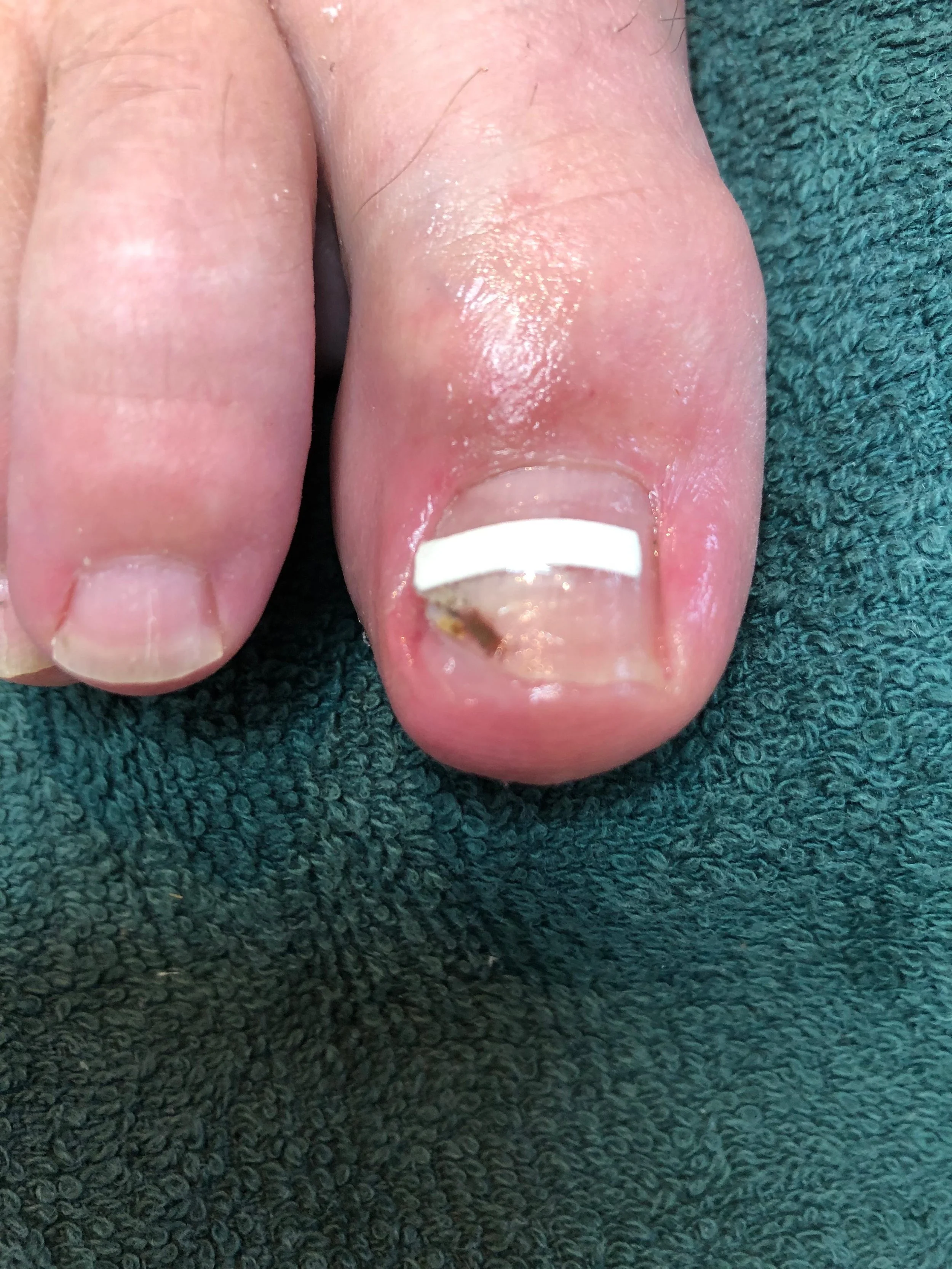 Behandeling cliënt 3 | na