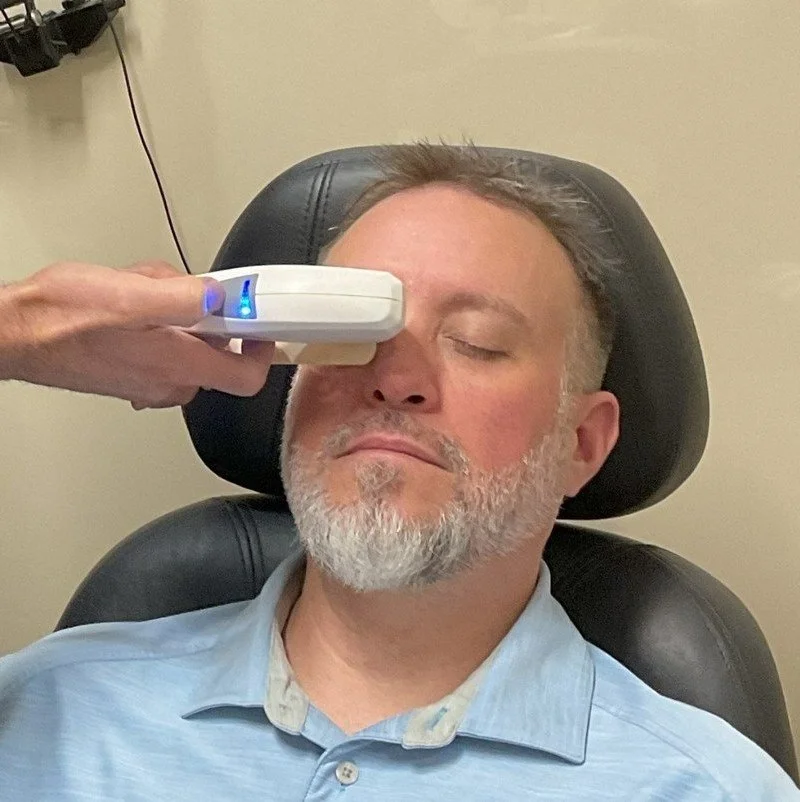 IPL dry eye treatment performed around the eyelids and face