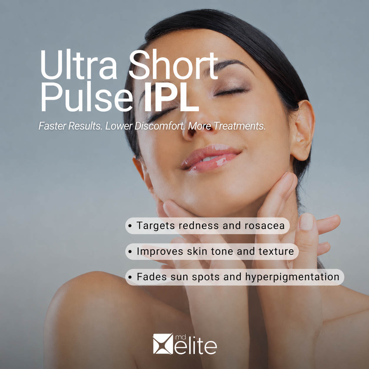 Secondary skin benefits that may occur with IPL and related dry eye treatment technologies