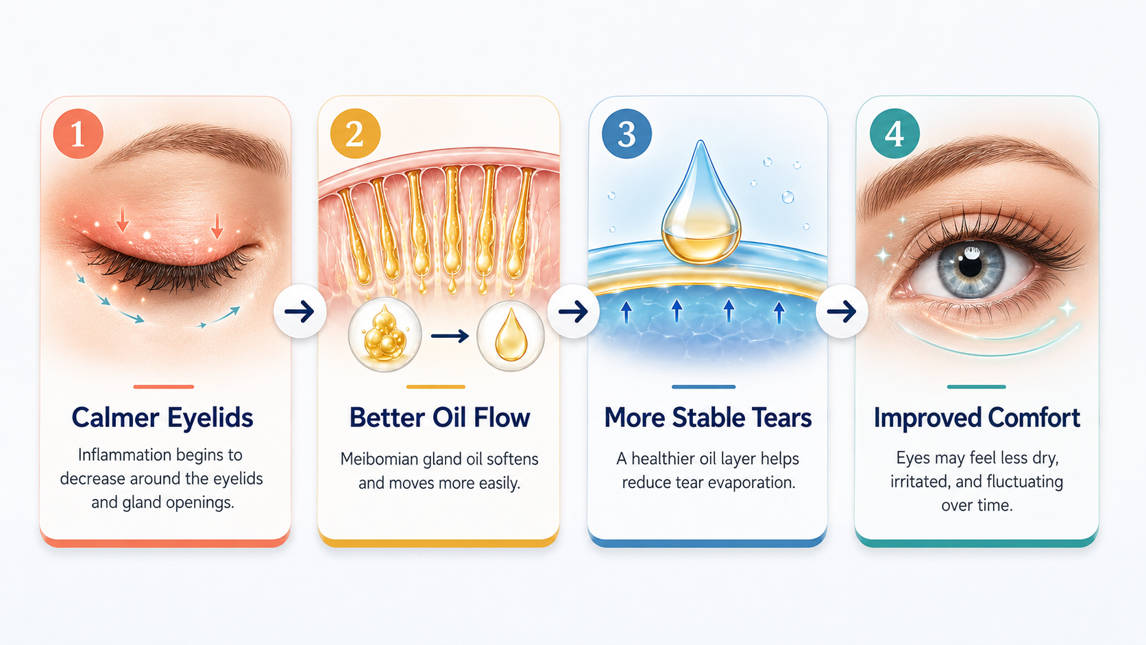 Dry eye treatment progression from calmer eyelids to better oil flow, more stable tears, and improved comfort