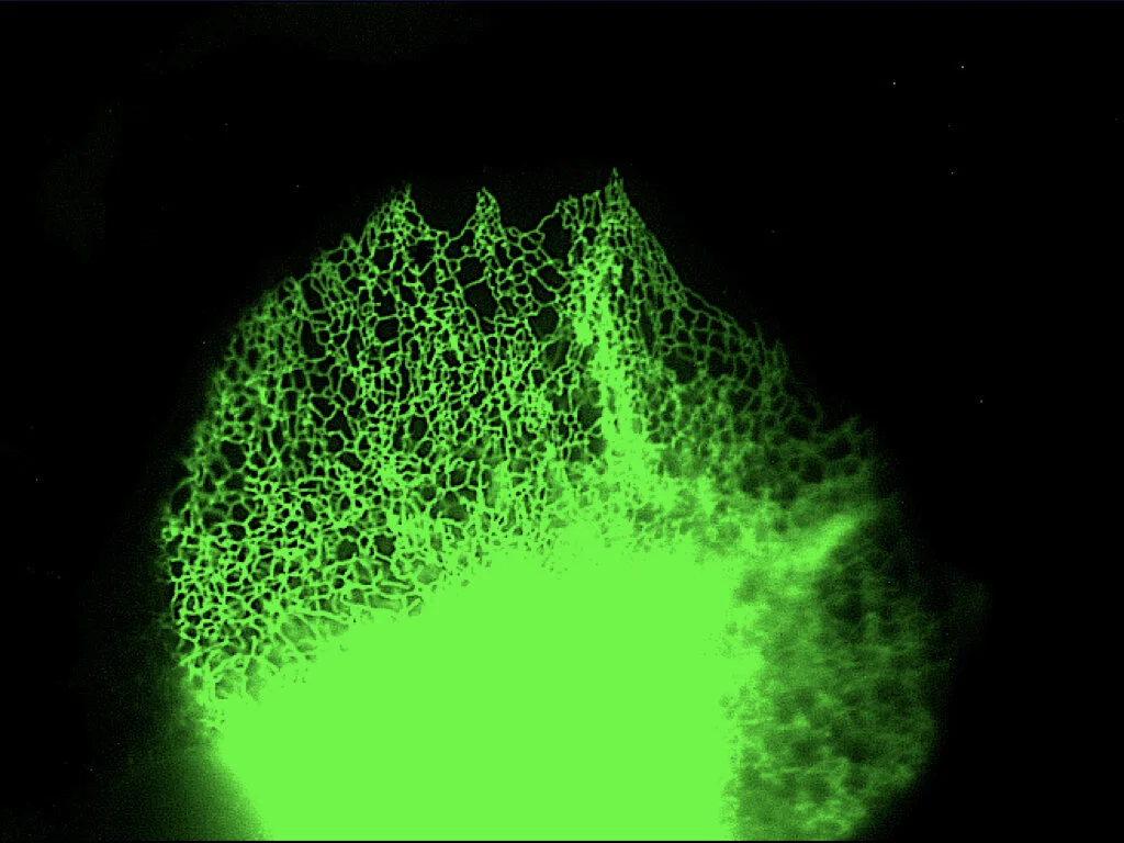 Isoprenylcysteine carboxylmethyltransferase (ICMT)