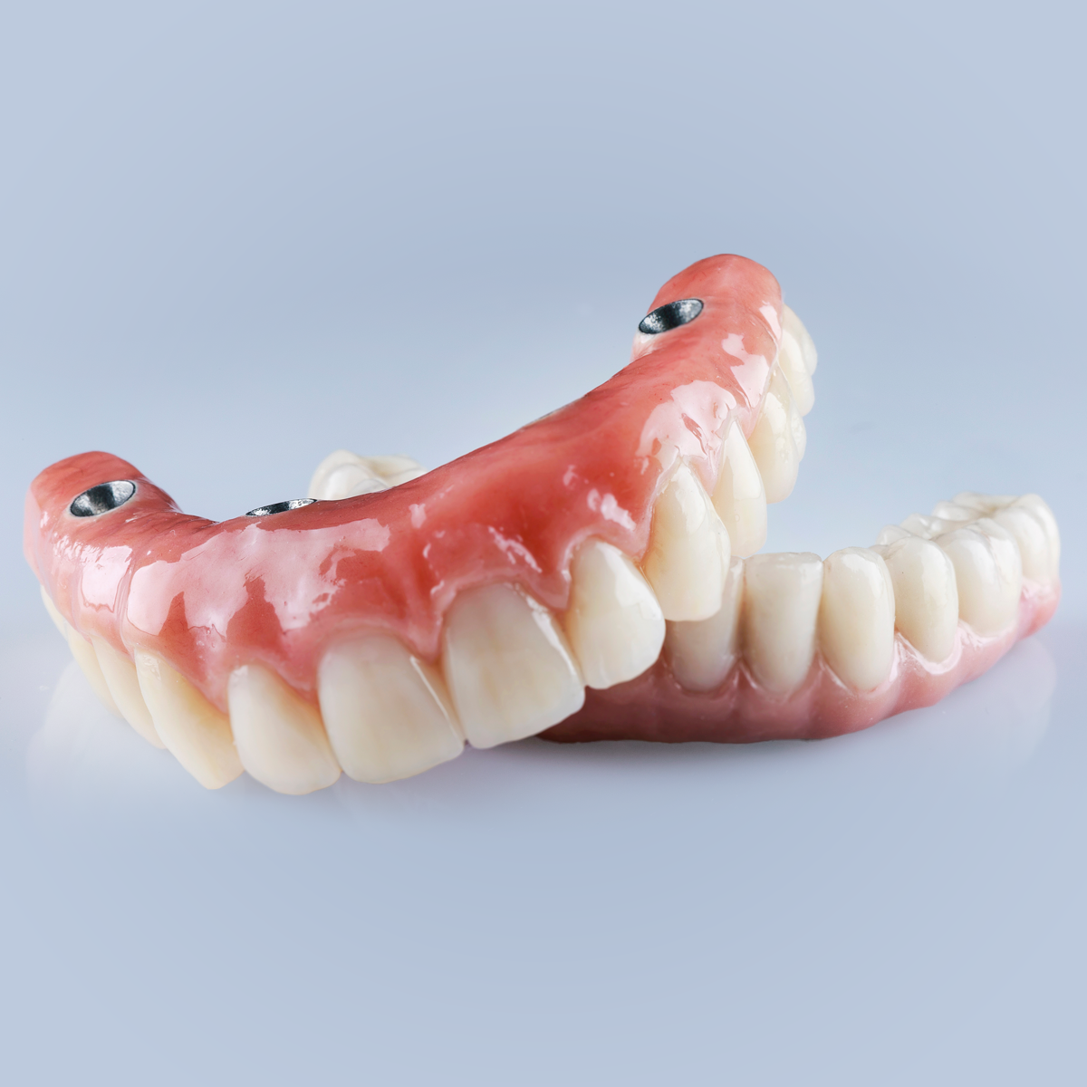 Are You a Candidate for All-on-4 Dental Implants?